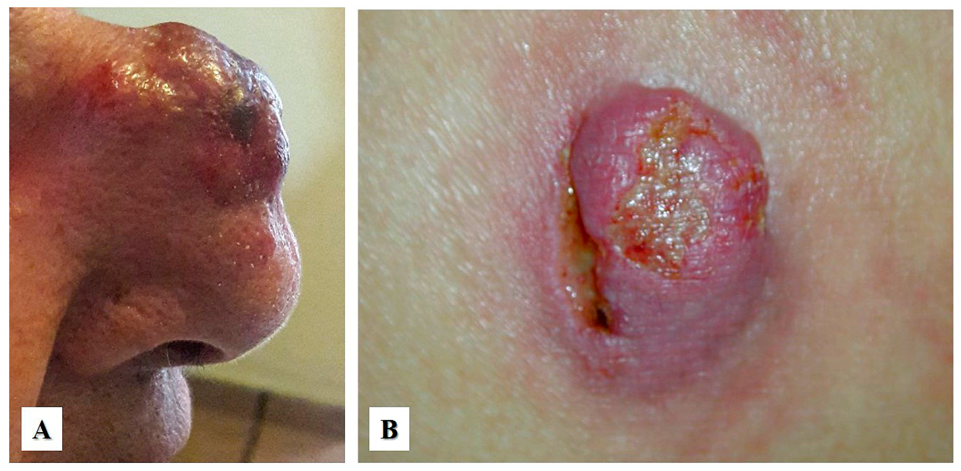 Cancers 15 04098 g001 Cancers 15 04098 g001