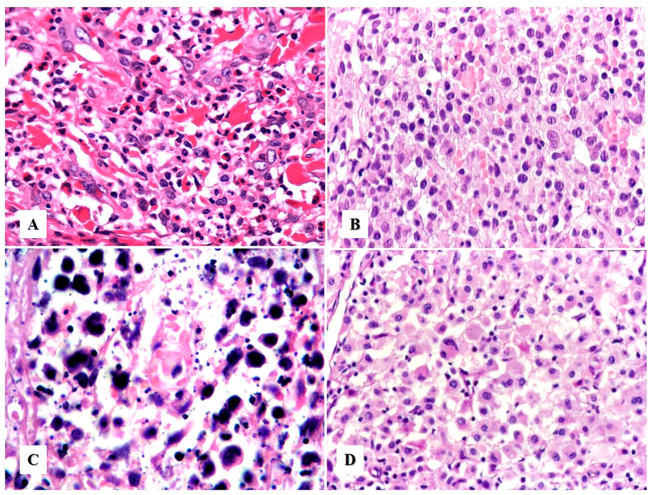 Cancers 15 04098 g004 Cancers 15 04098 g004