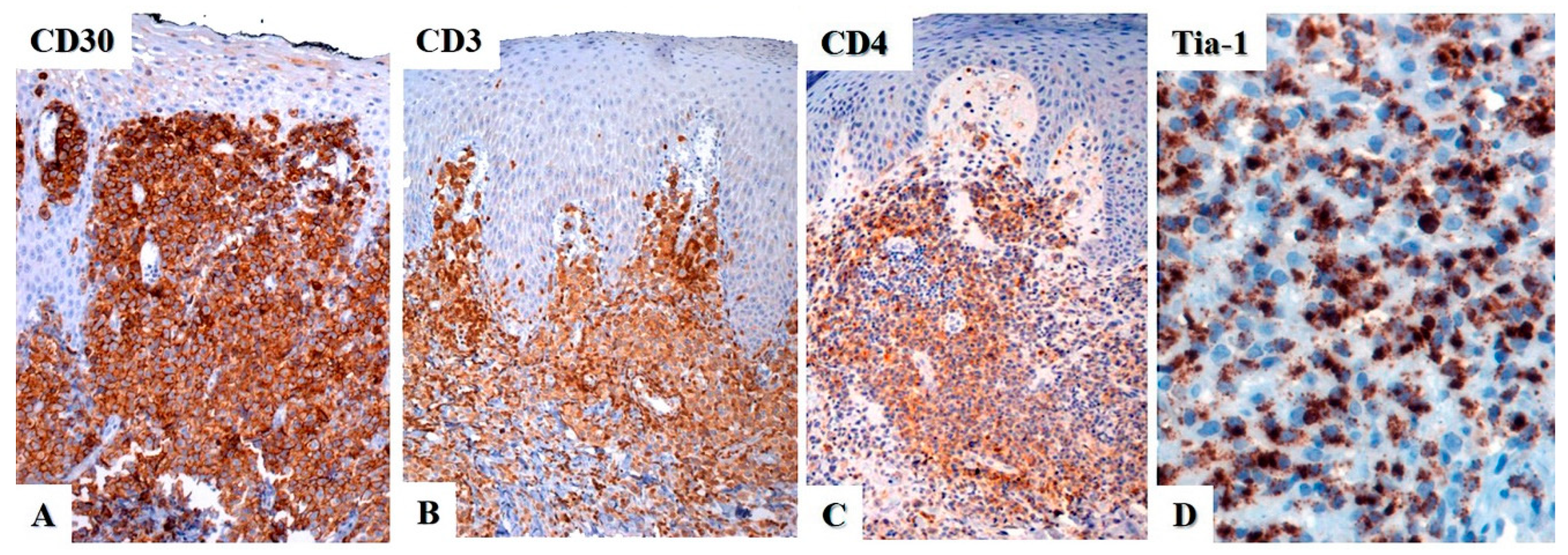 Cancers 15 04098 g005 Cancers 15 04098 g005