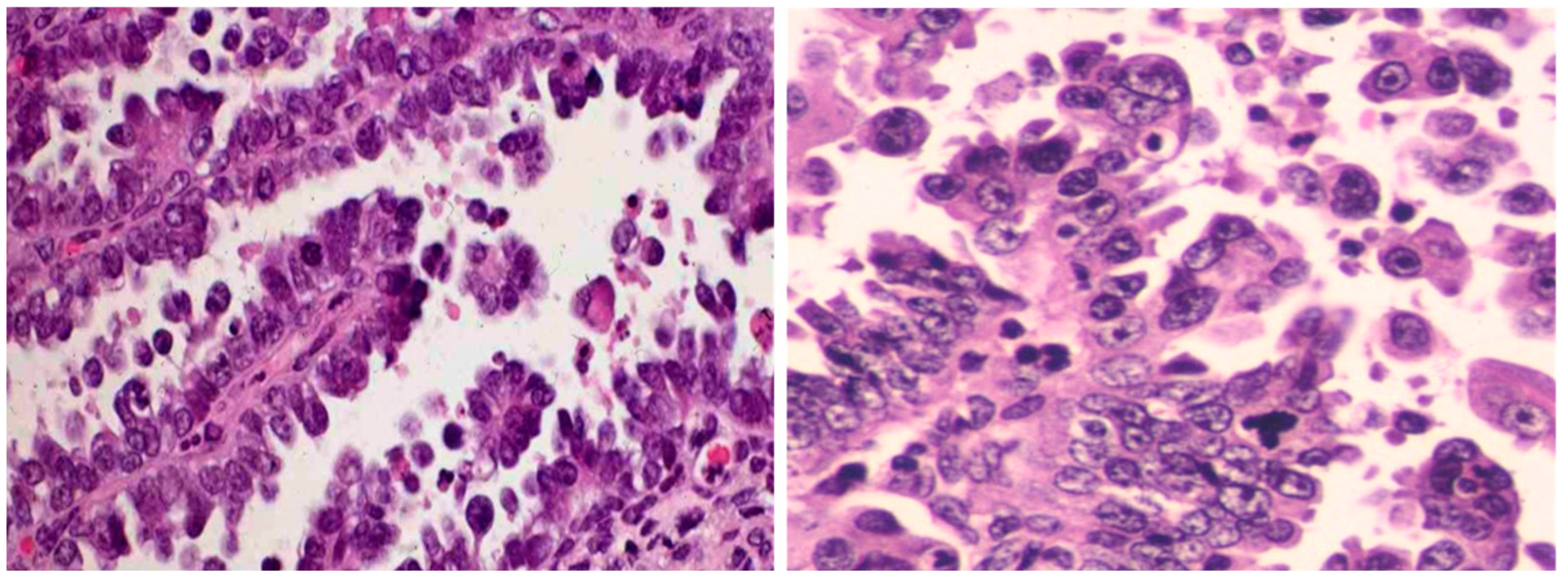 Cancers 15 04101 g001