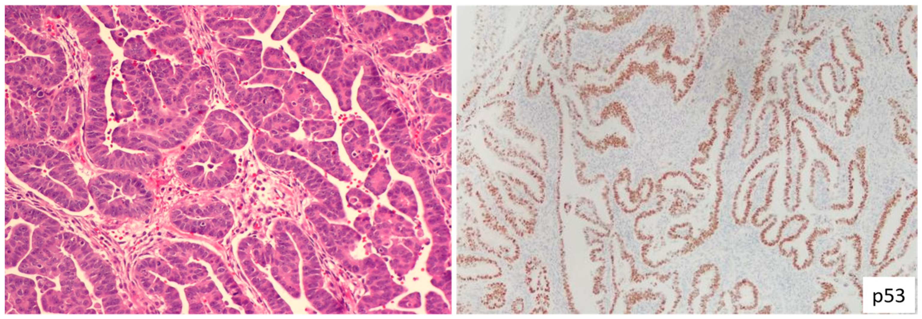 Cancers 15 04101 g002