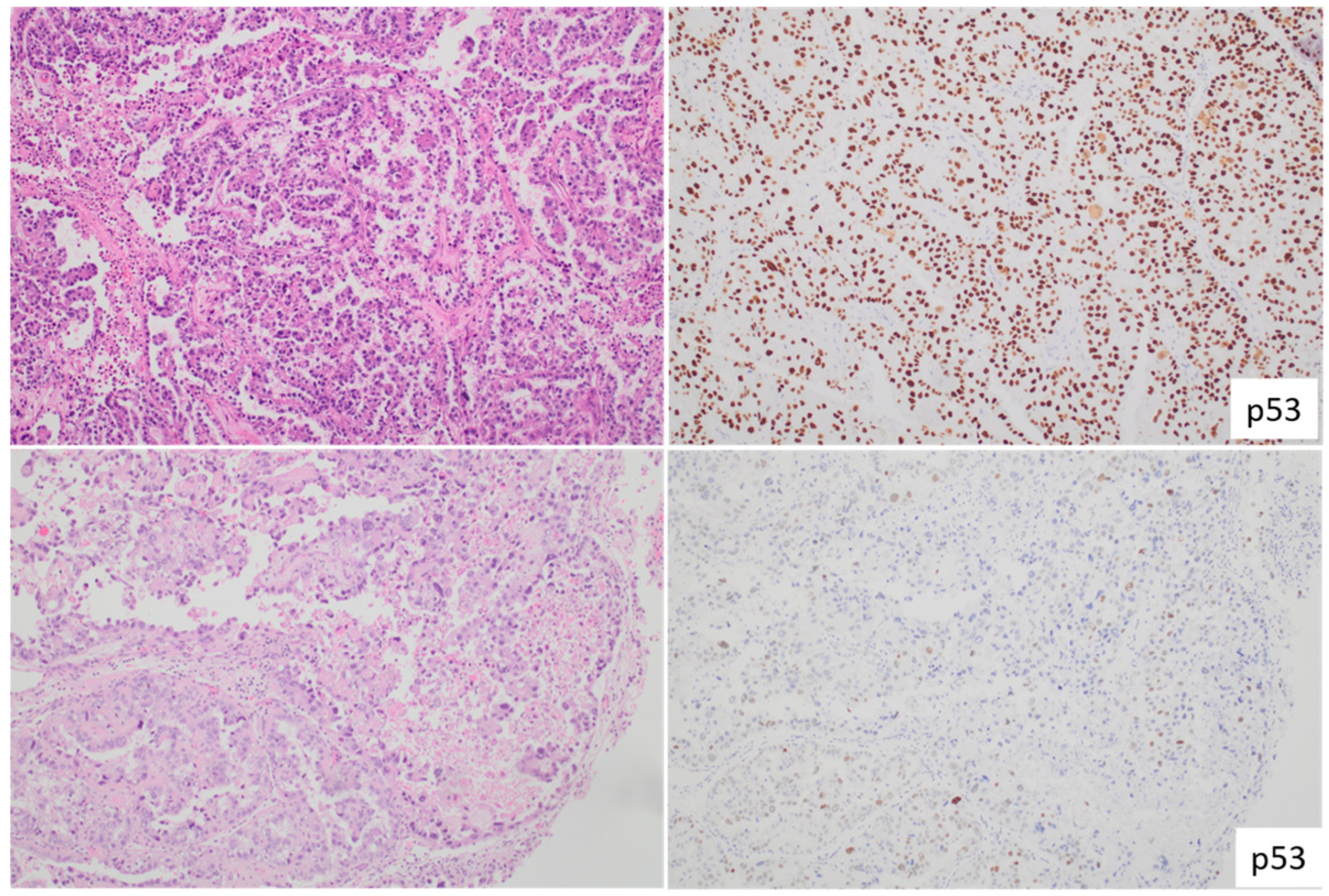 Cancers 15 04101 g003