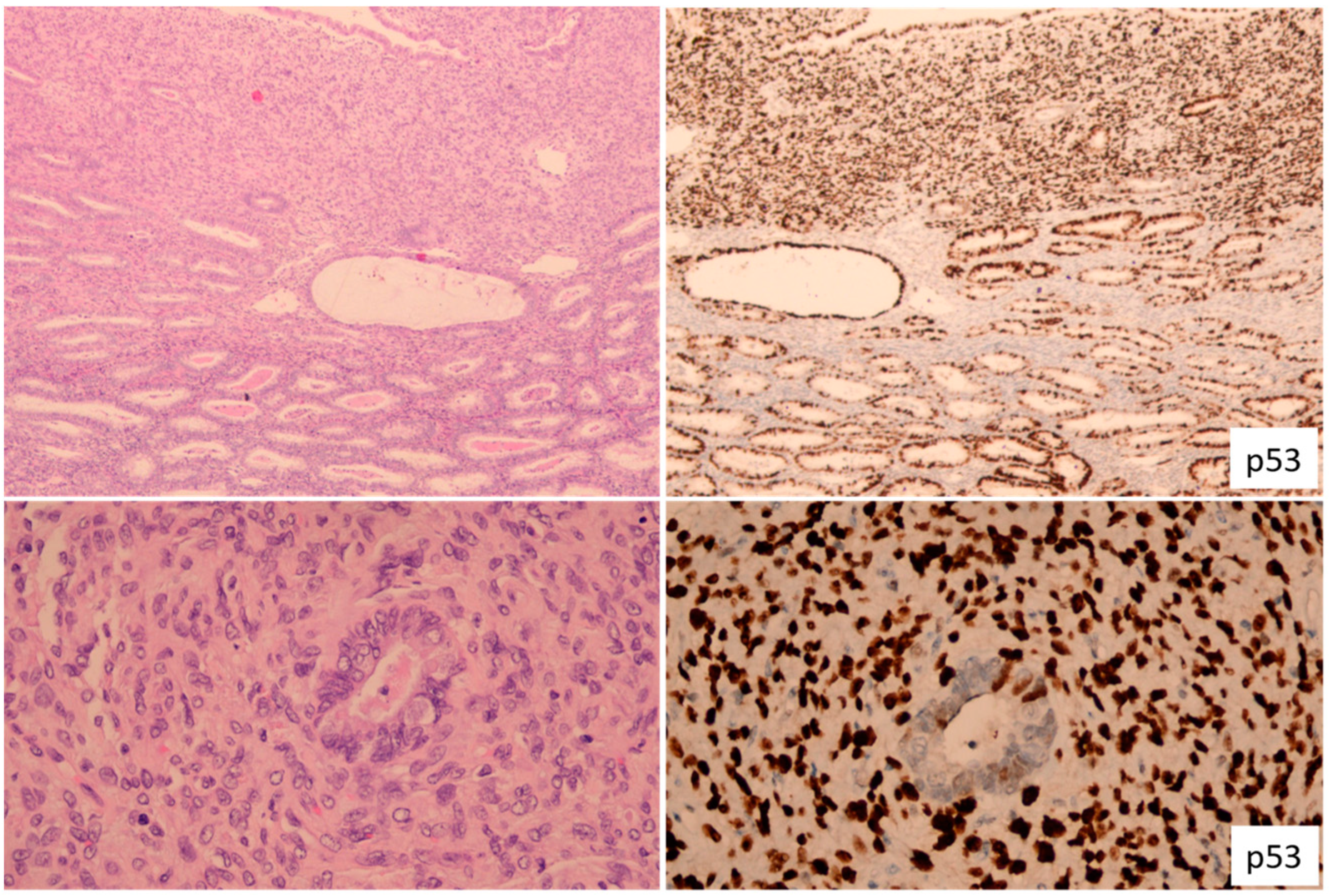 Cancers 15 04101 g004