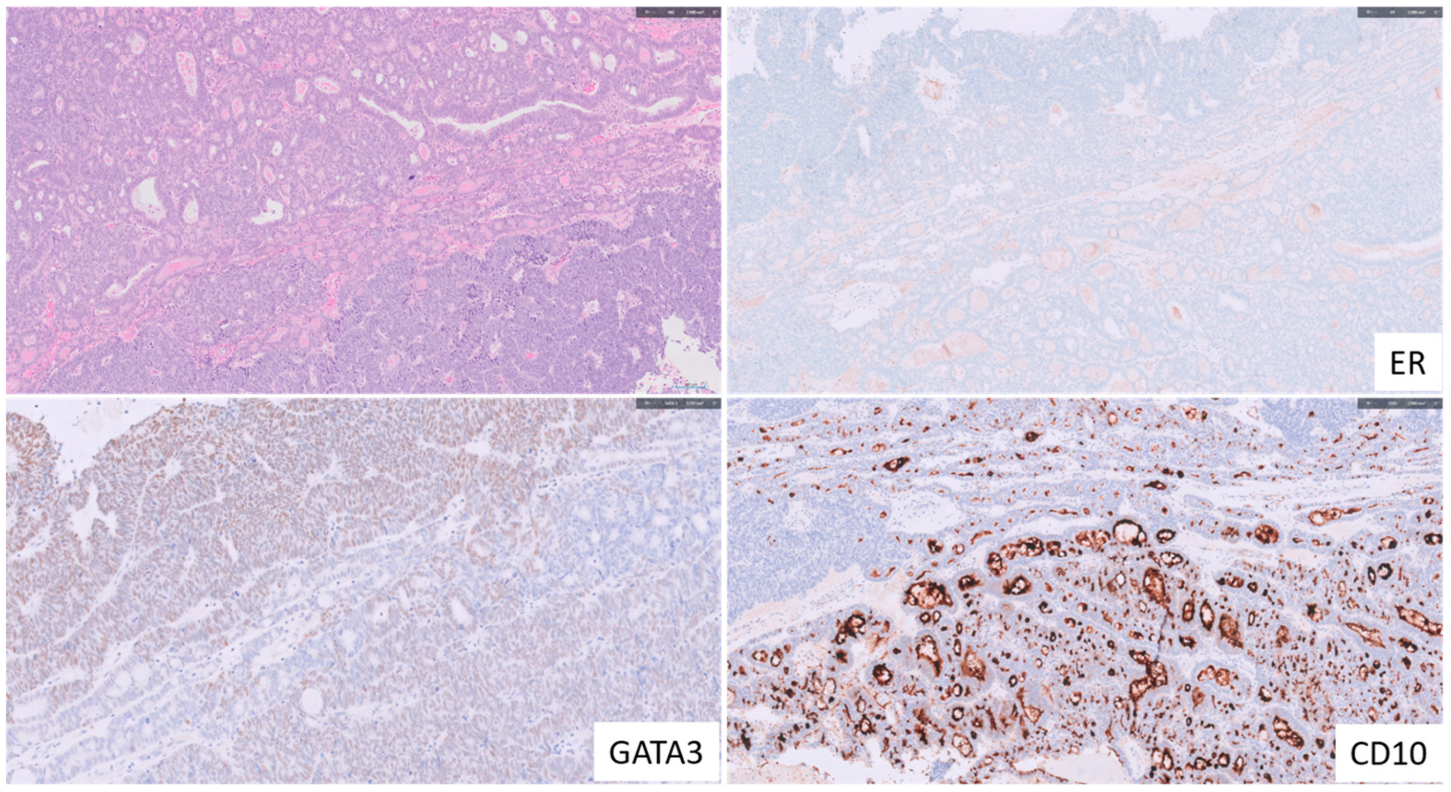 Cancers 15 04101 g005