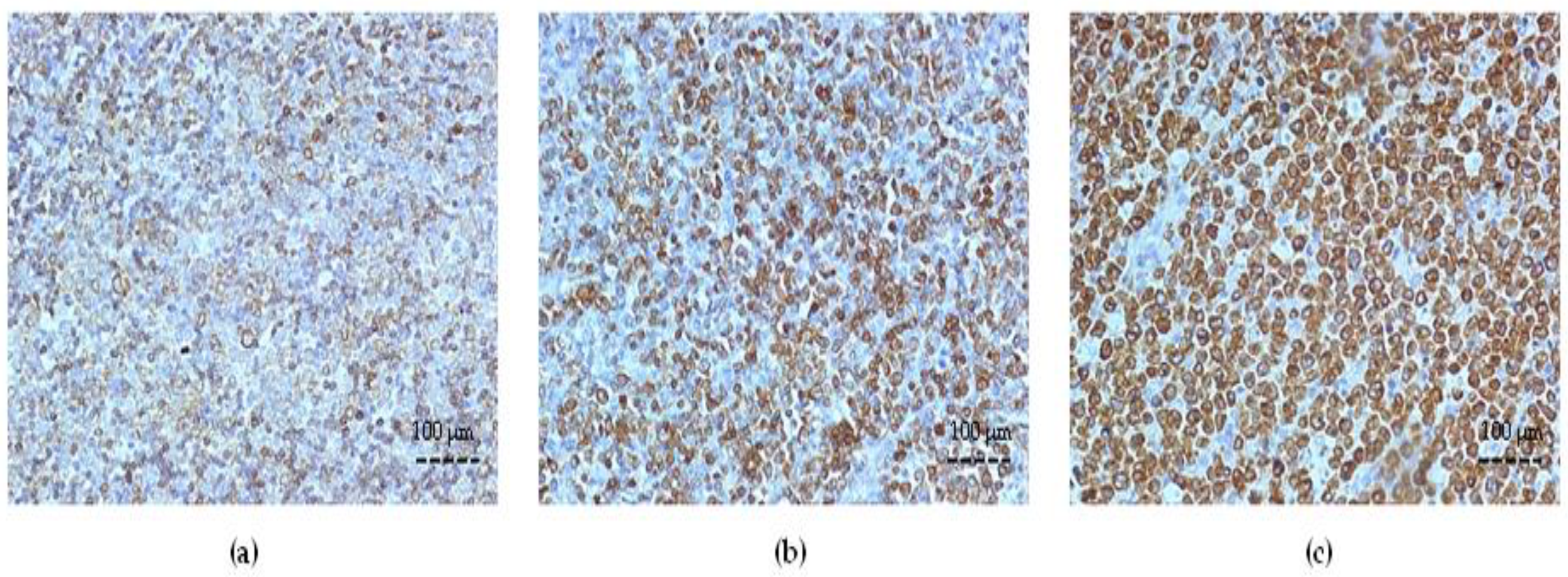 Cancers 15 04106 g001 Cancers 15 04106 g001