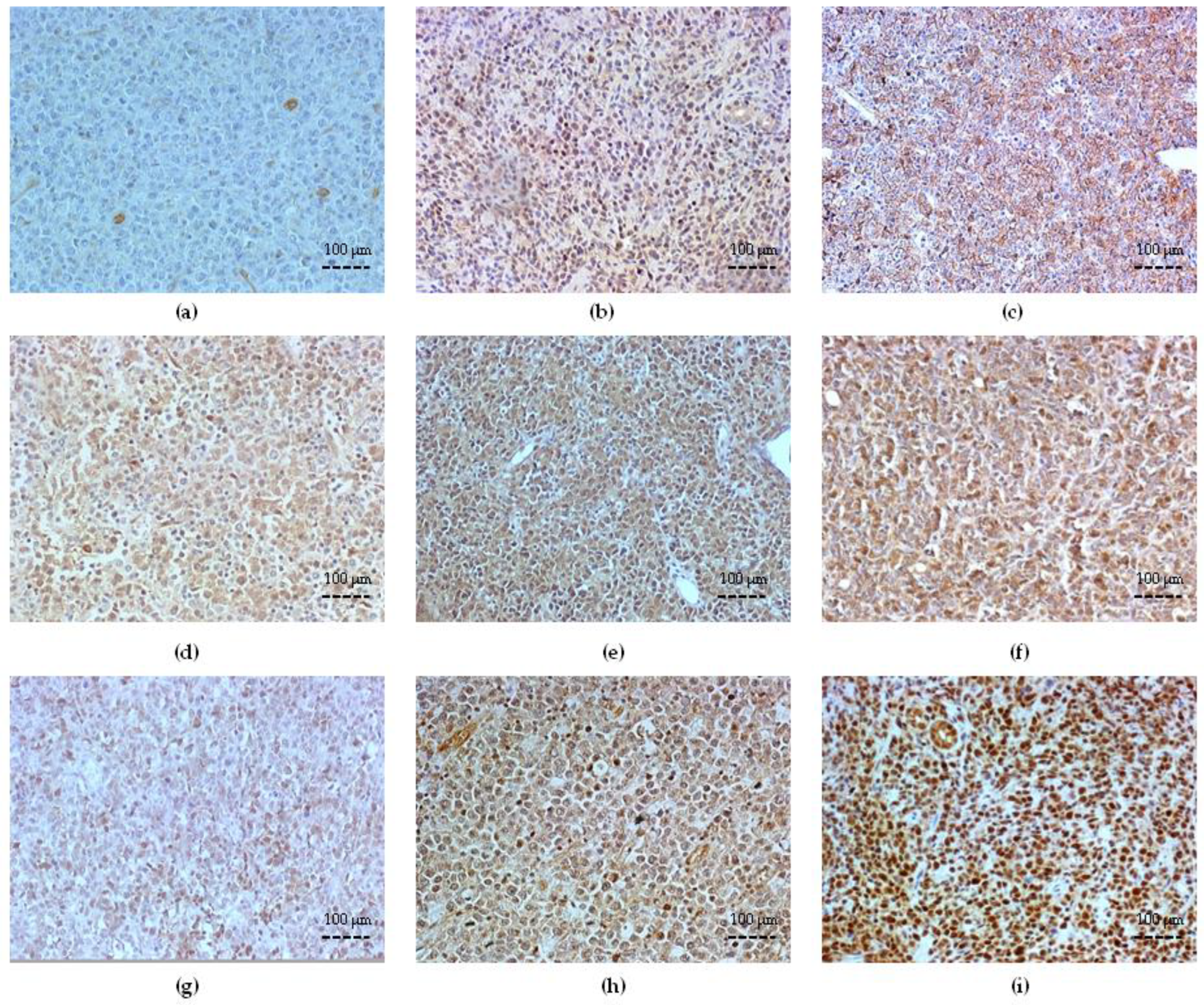 Cancers 15 04106 g002 Cancers 15 04106 g002