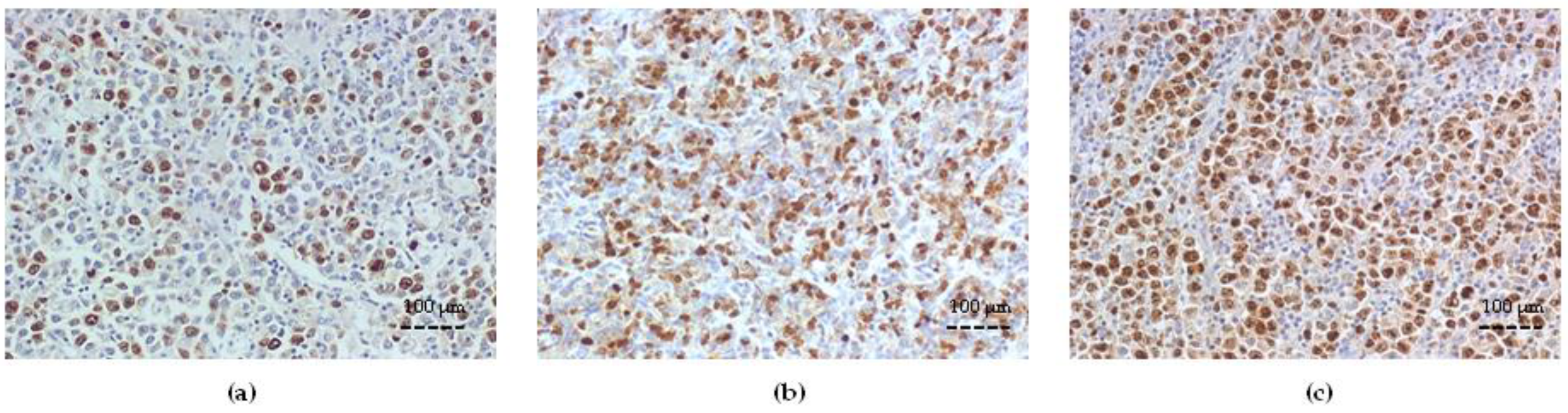 Cancers 15 04106 g004 Cancers 15 04106 g004