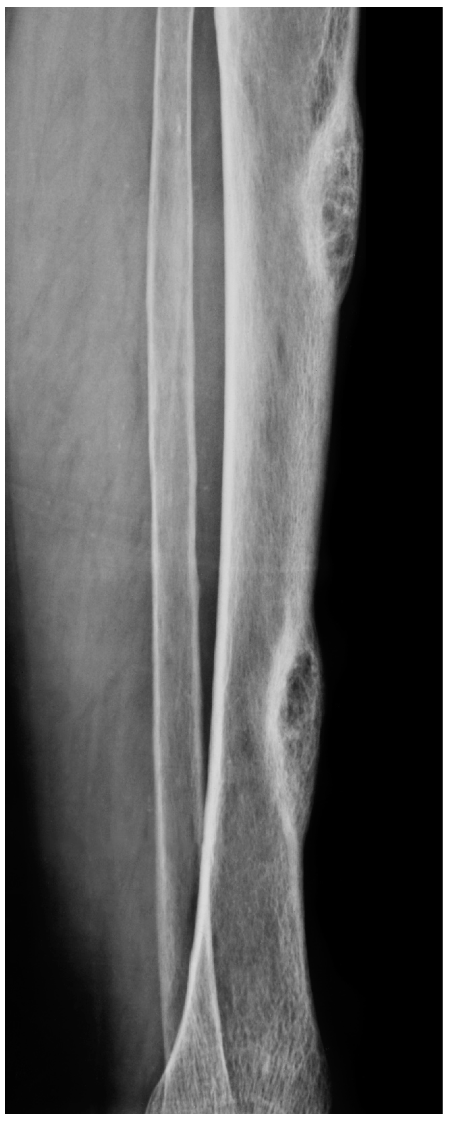 Cancers 15 04107 g002 Cancers 15 04107 g002