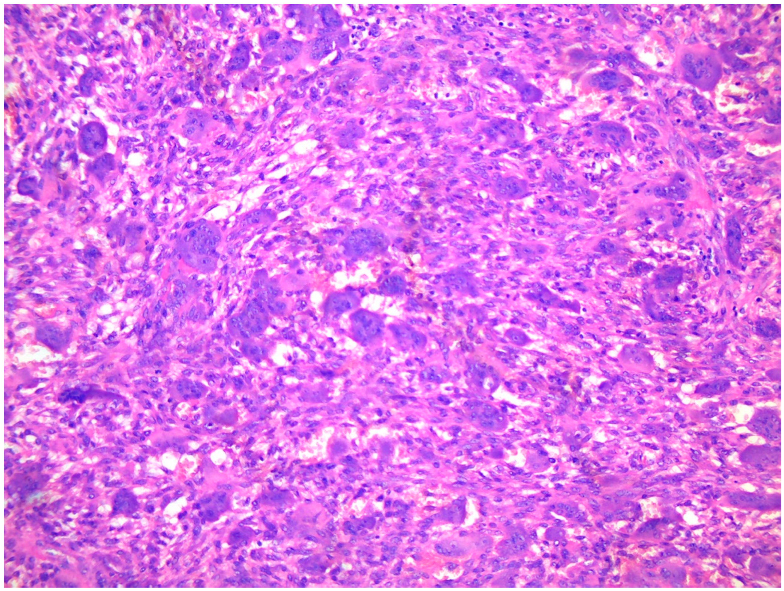 Cancers 15 04107 g004 Cancers 15 04107 g004