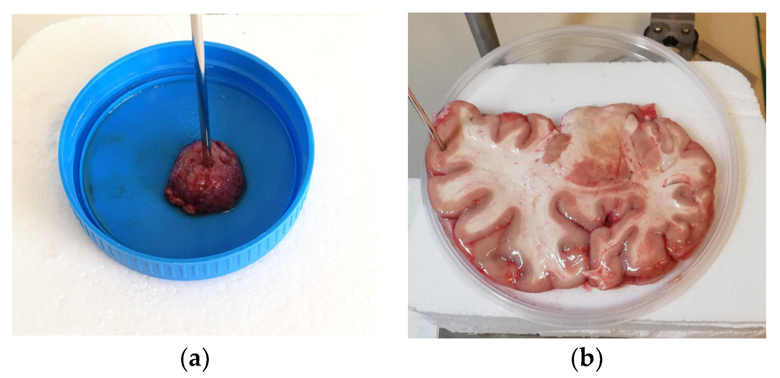 Cancers 15 04153 g002 Cancers 15 04153 g002