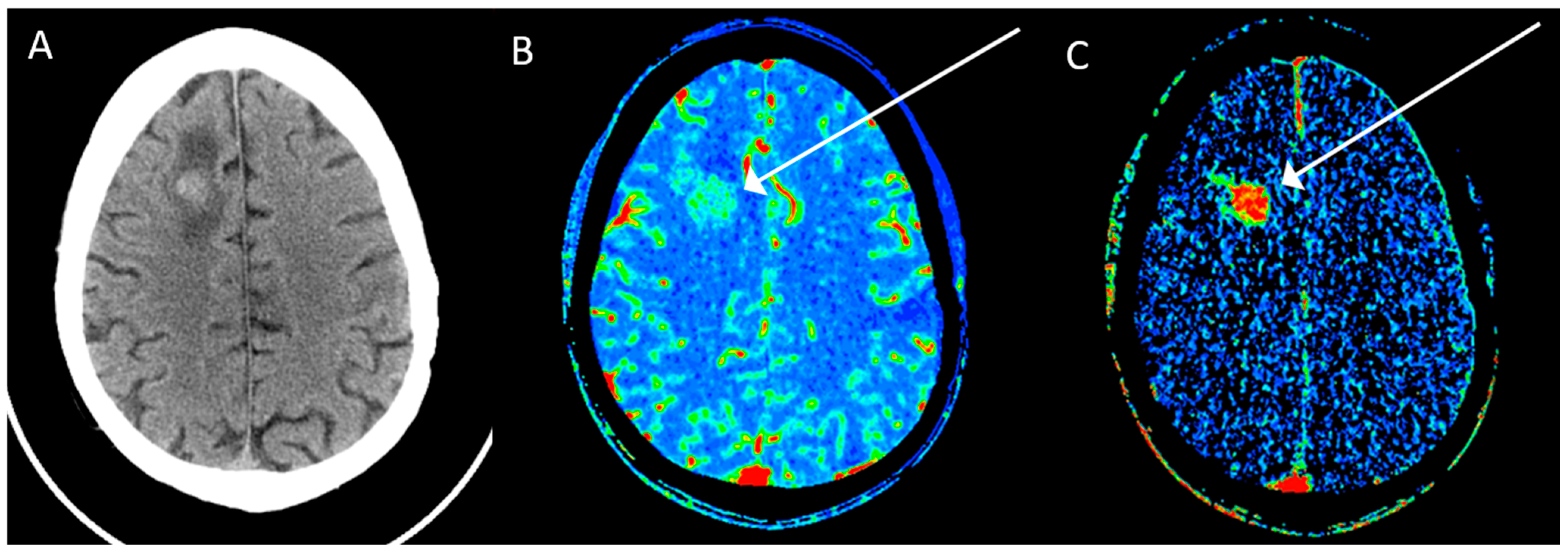 Cancers 15 04162 g001