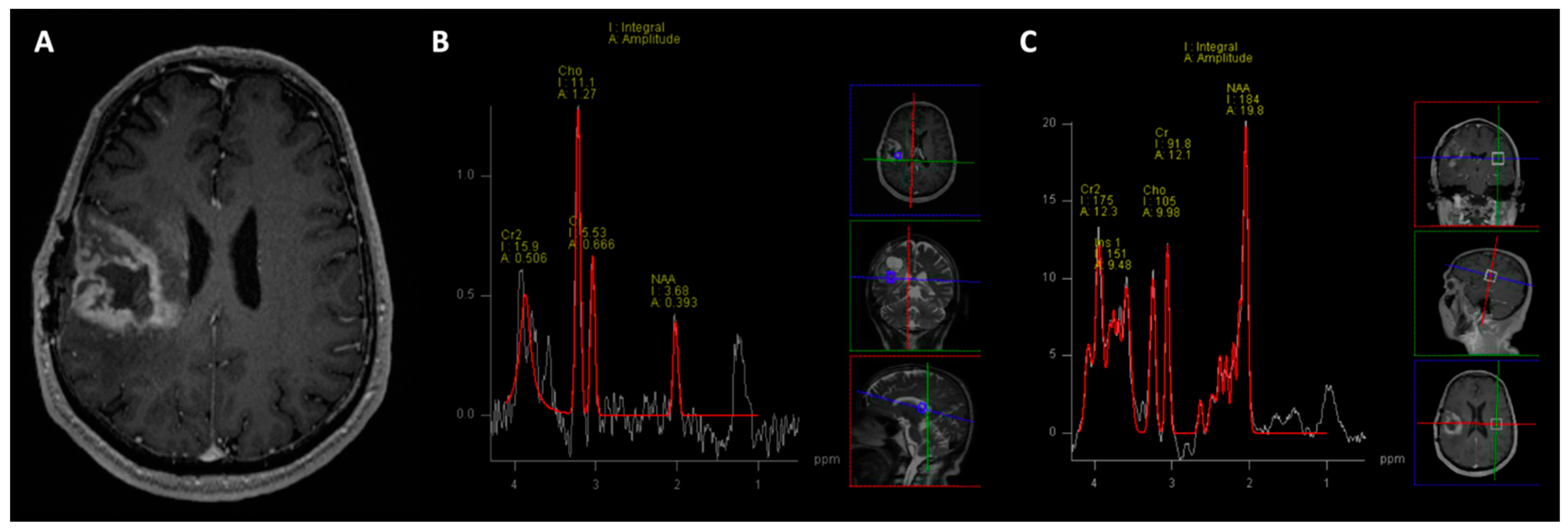 Cancers 15 04162 g003