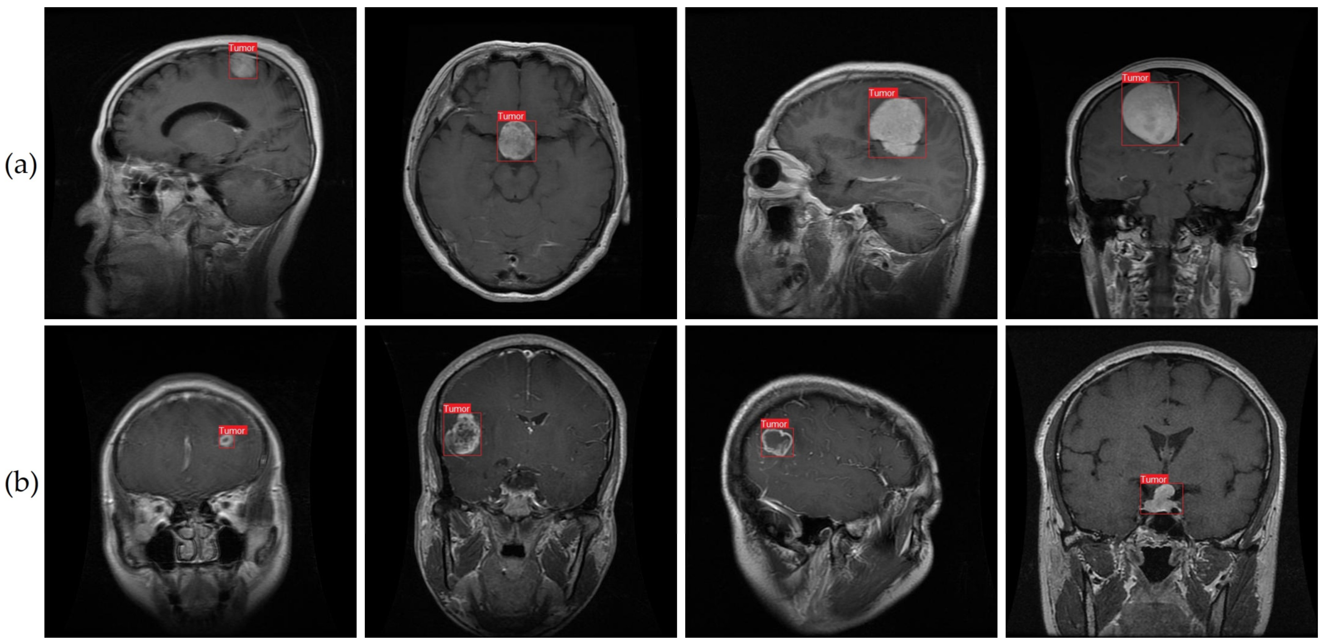 Cancers 15 04172 g011