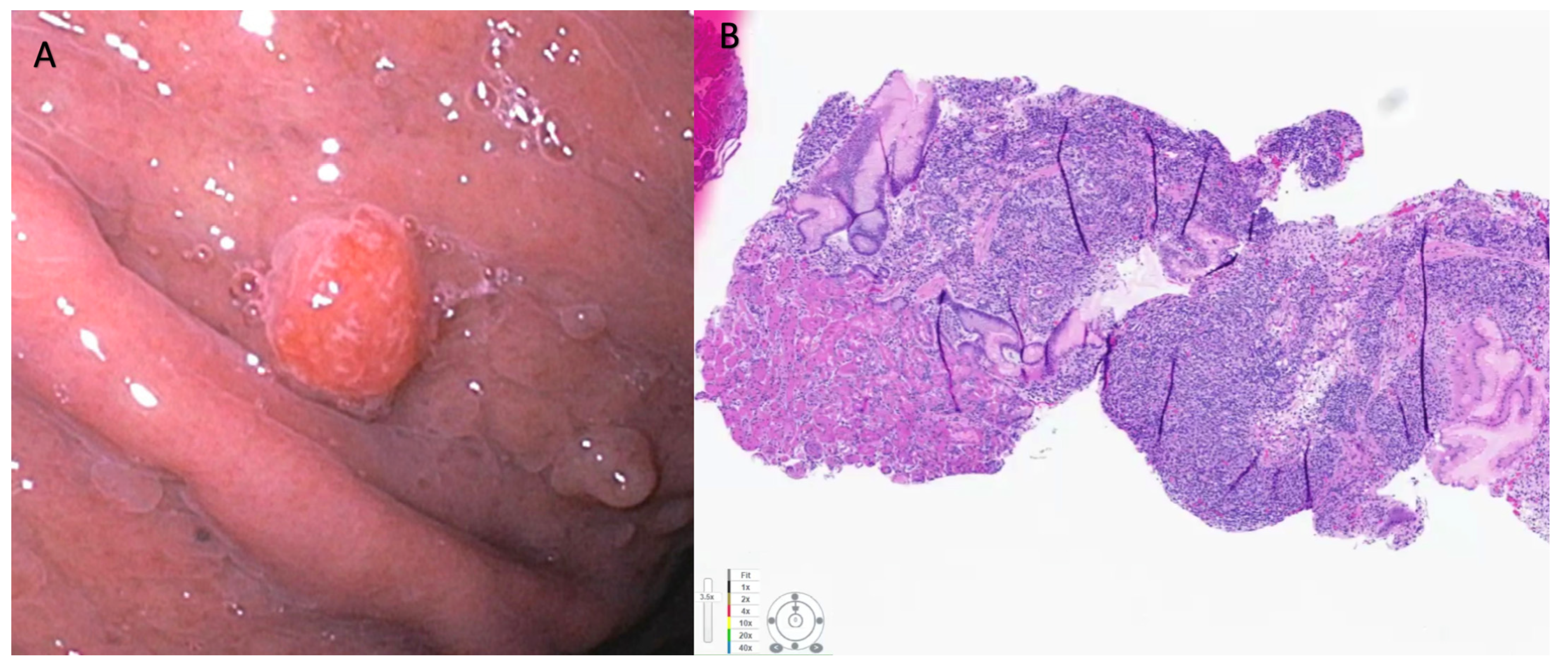 Cancers 15 04175 g001 Cancers 15 04175 g001