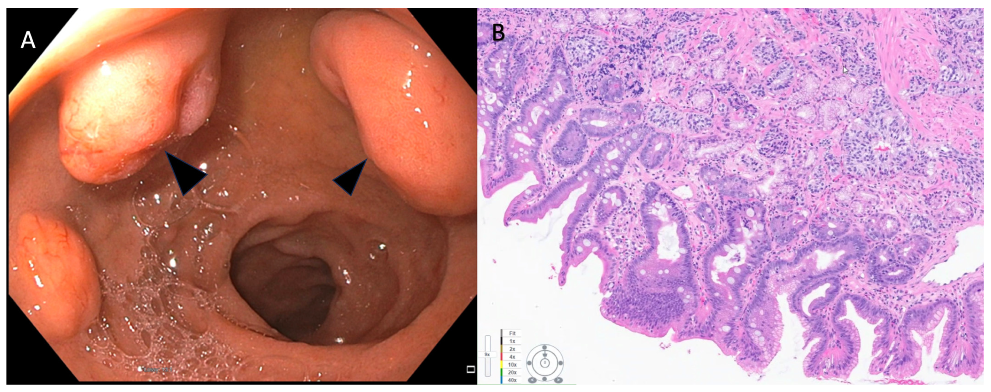 Cancers 15 04175 g002 Cancers 15 04175 g002