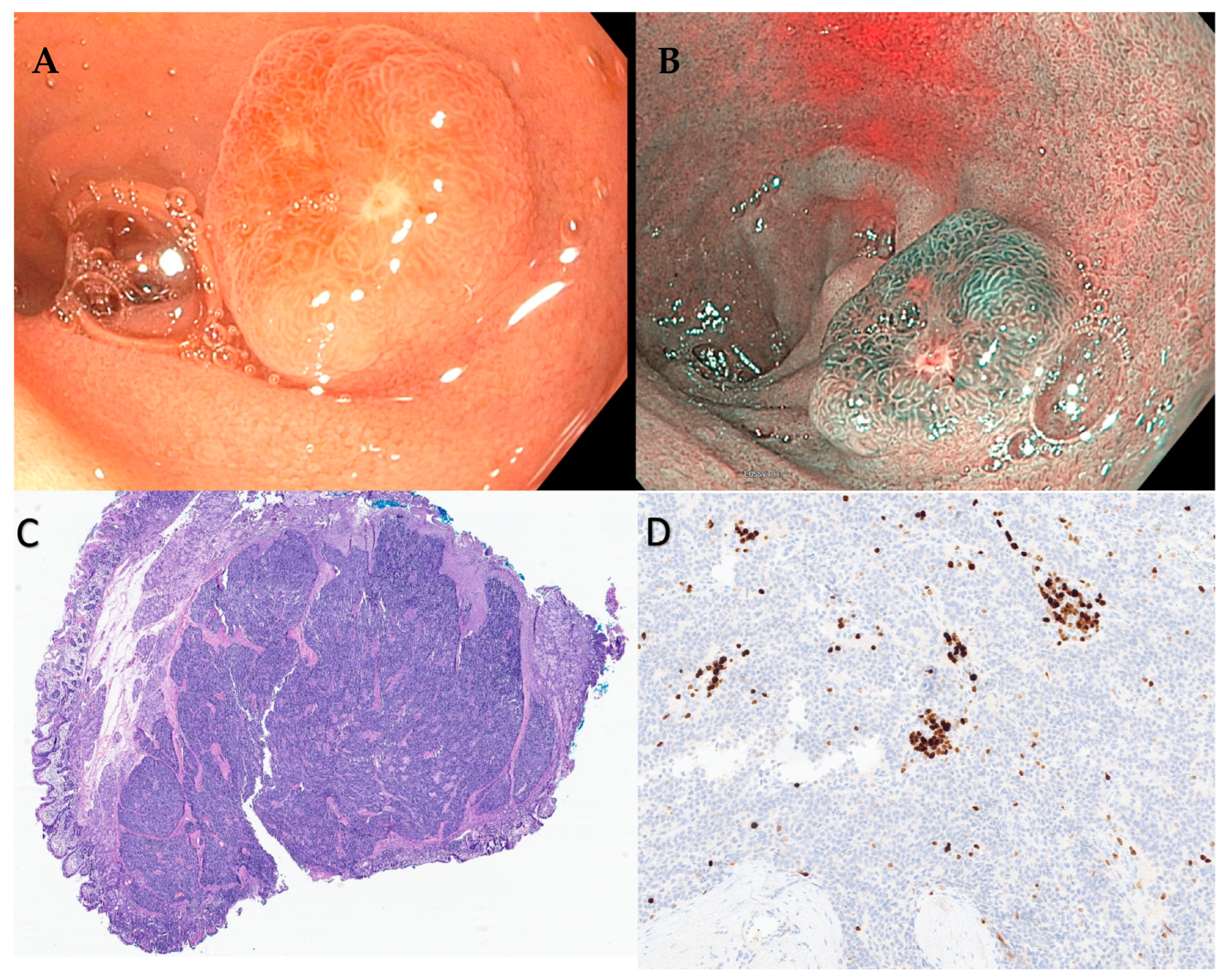 Cancers 15 04175 g003 Cancers 15 04175 g003