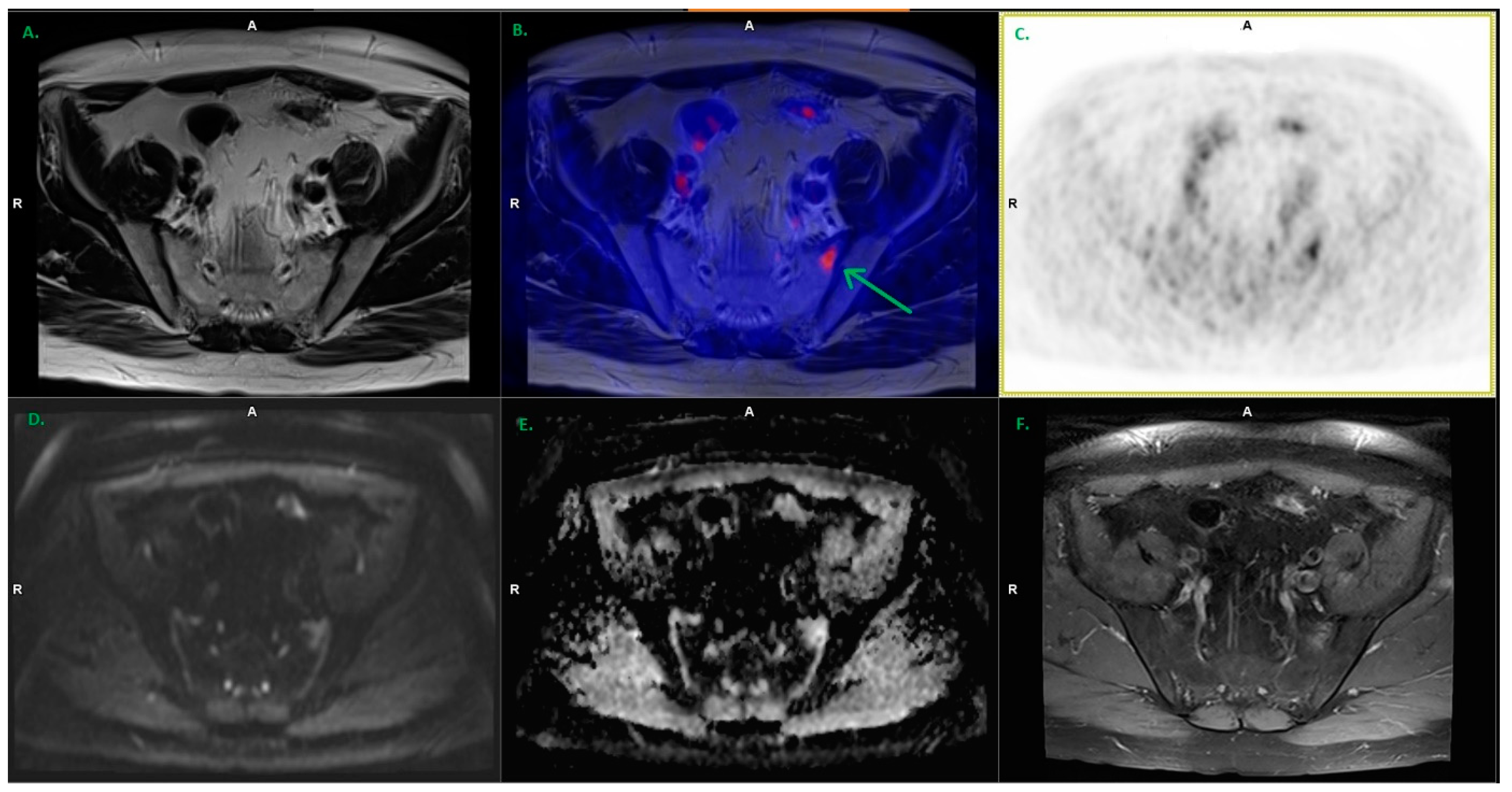Cancers 15 04185 g003