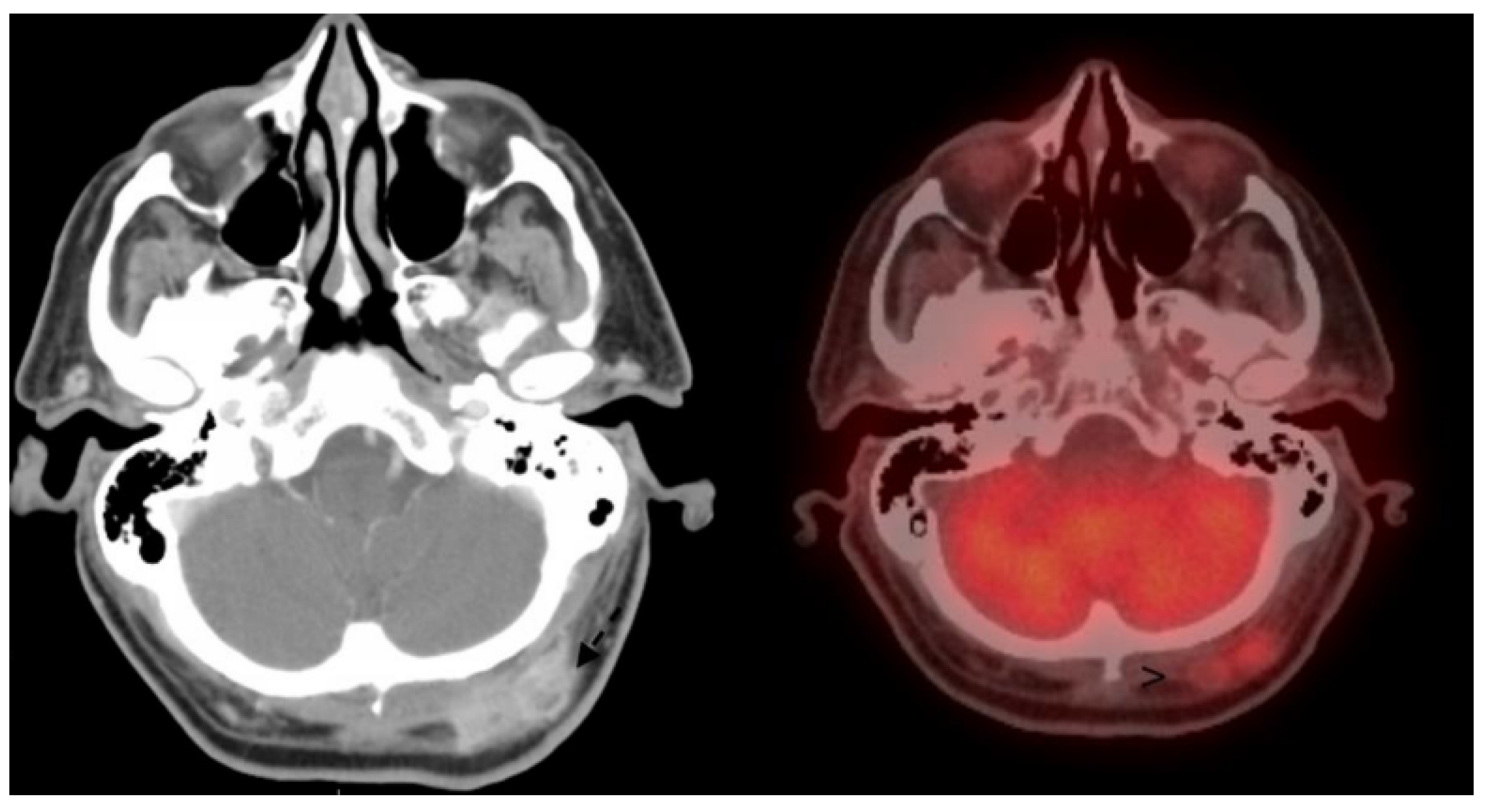 Cancers 15 04201 g001 Cancers 15 04201 g001