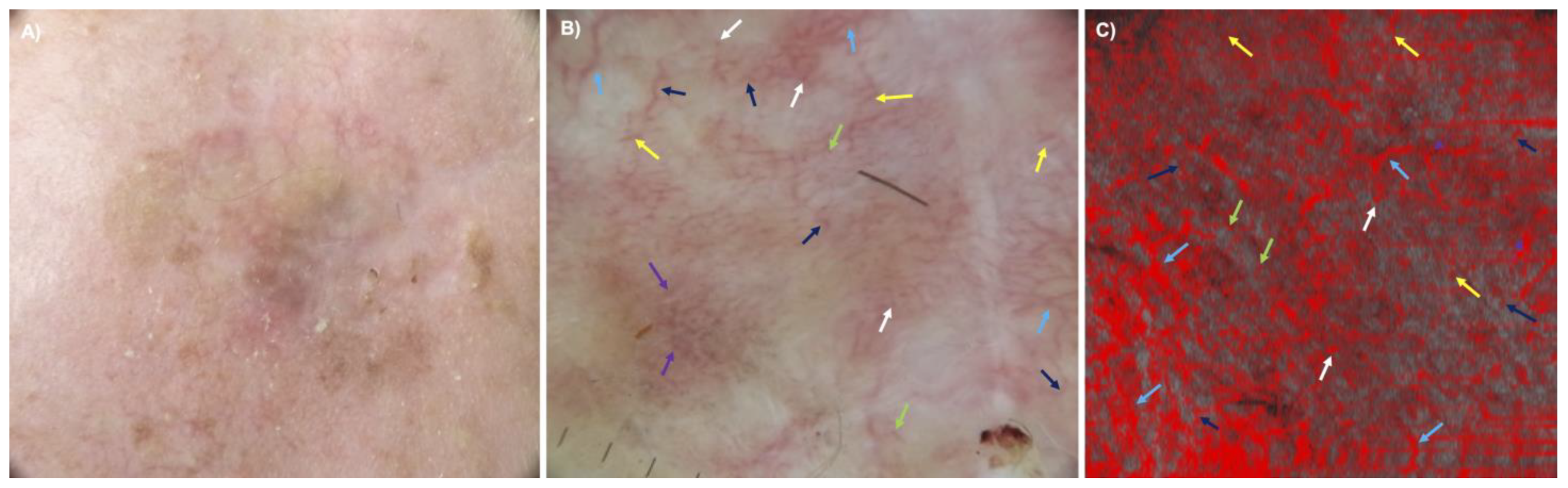 Cancers 15 04222 g007