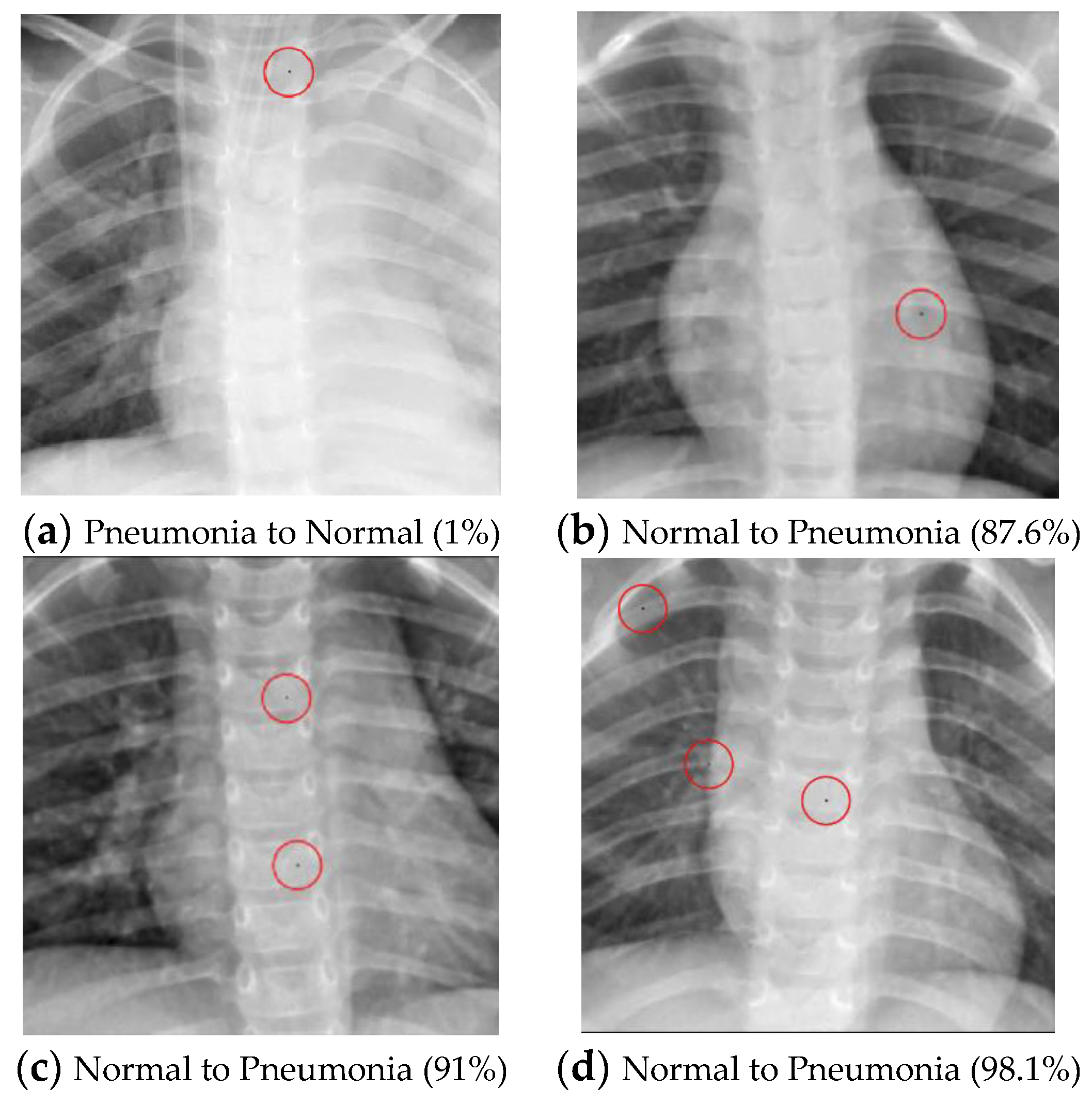 Cancers 15 04228 g004