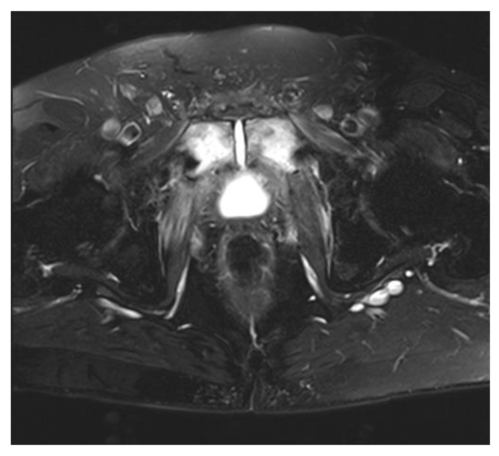 Cancers 15 04238 g001 Cancers 15 04238 g001