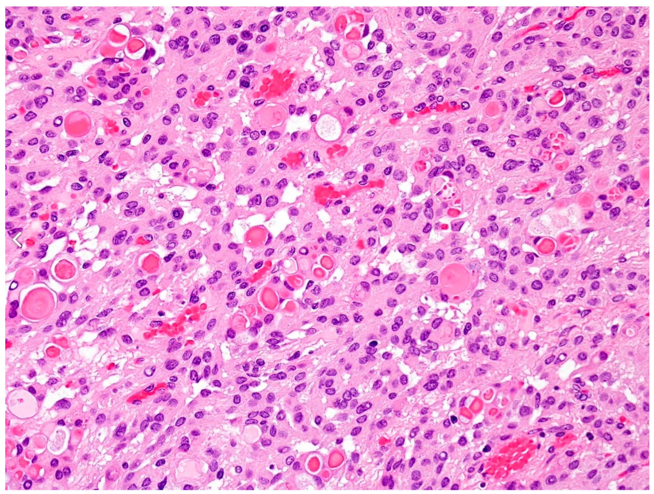 Cancers 15 04251 g001 Cancers 15 04251 g001