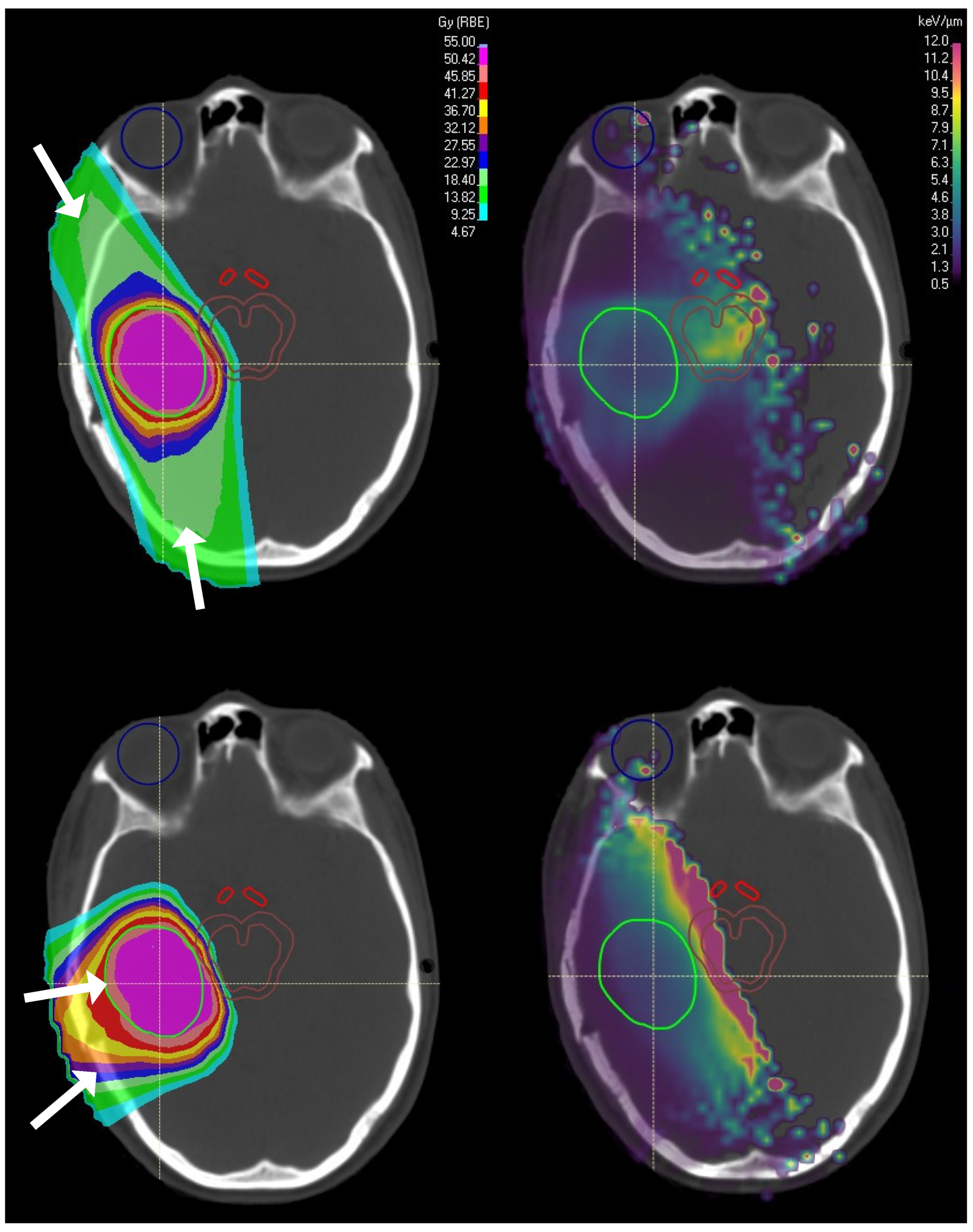 Cancers 15 04268 g002 Cancers 15 04268 g002