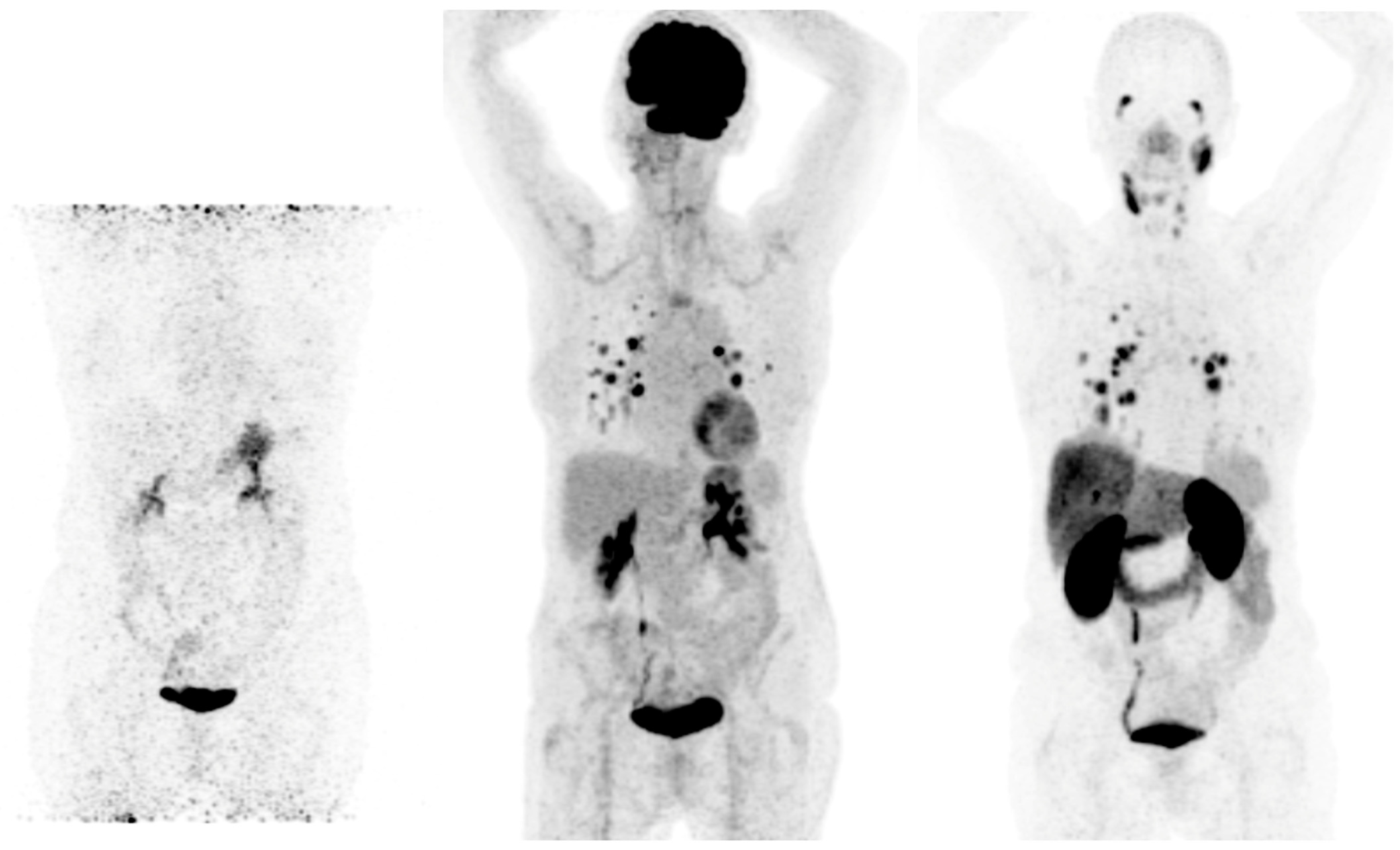 Cancers 15 04290 g002 Cancers 15 04290 g002