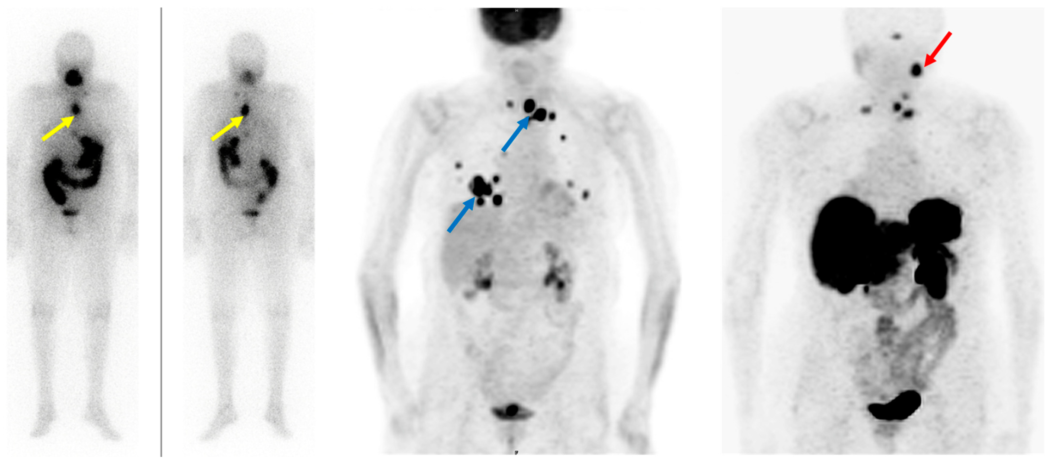 Cancers 15 04290 g003 Cancers 15 04290 g003