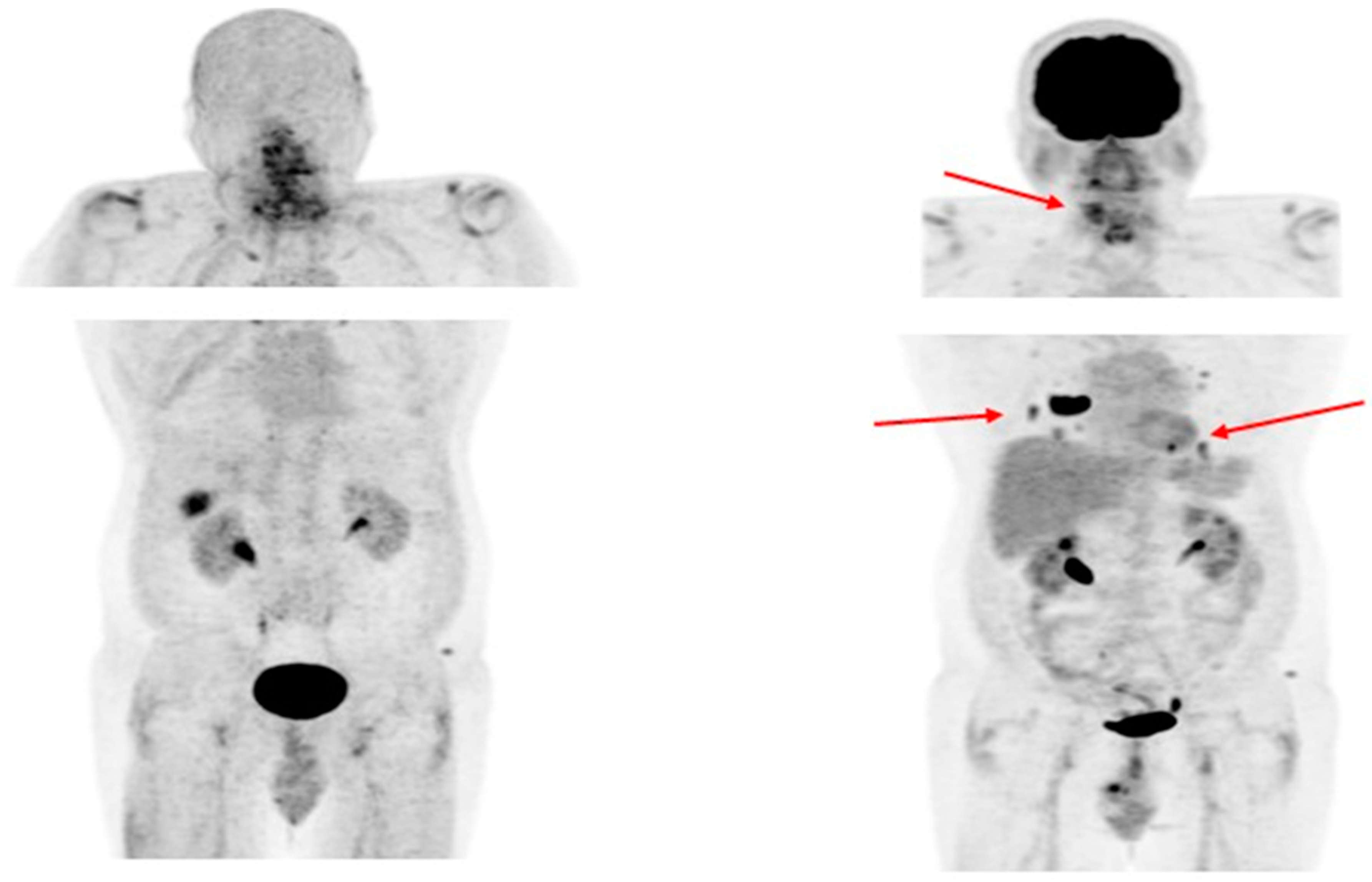 Cancers 15 04290 g004 Cancers 15 04290 g004