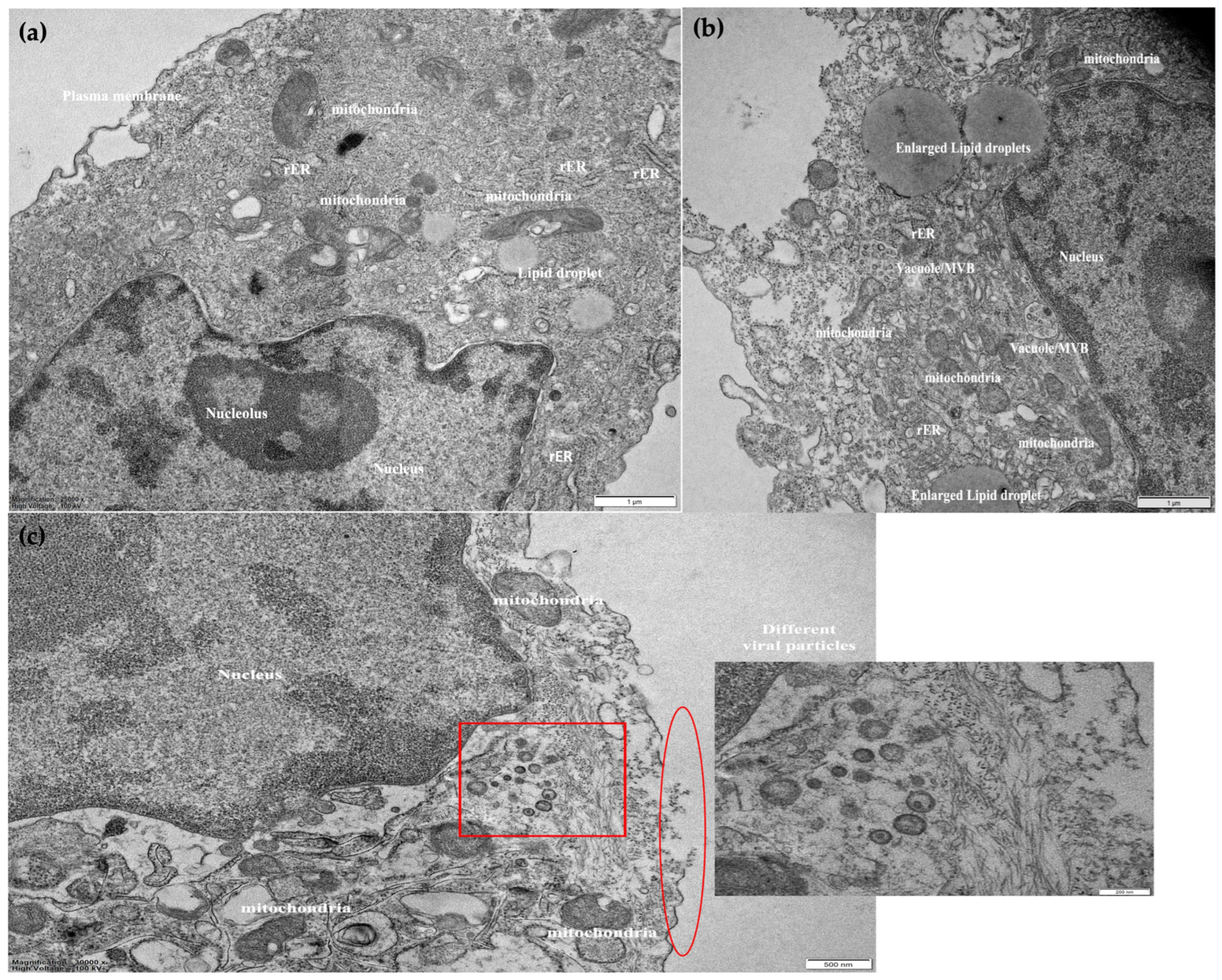 Cancers 15 04304 g004