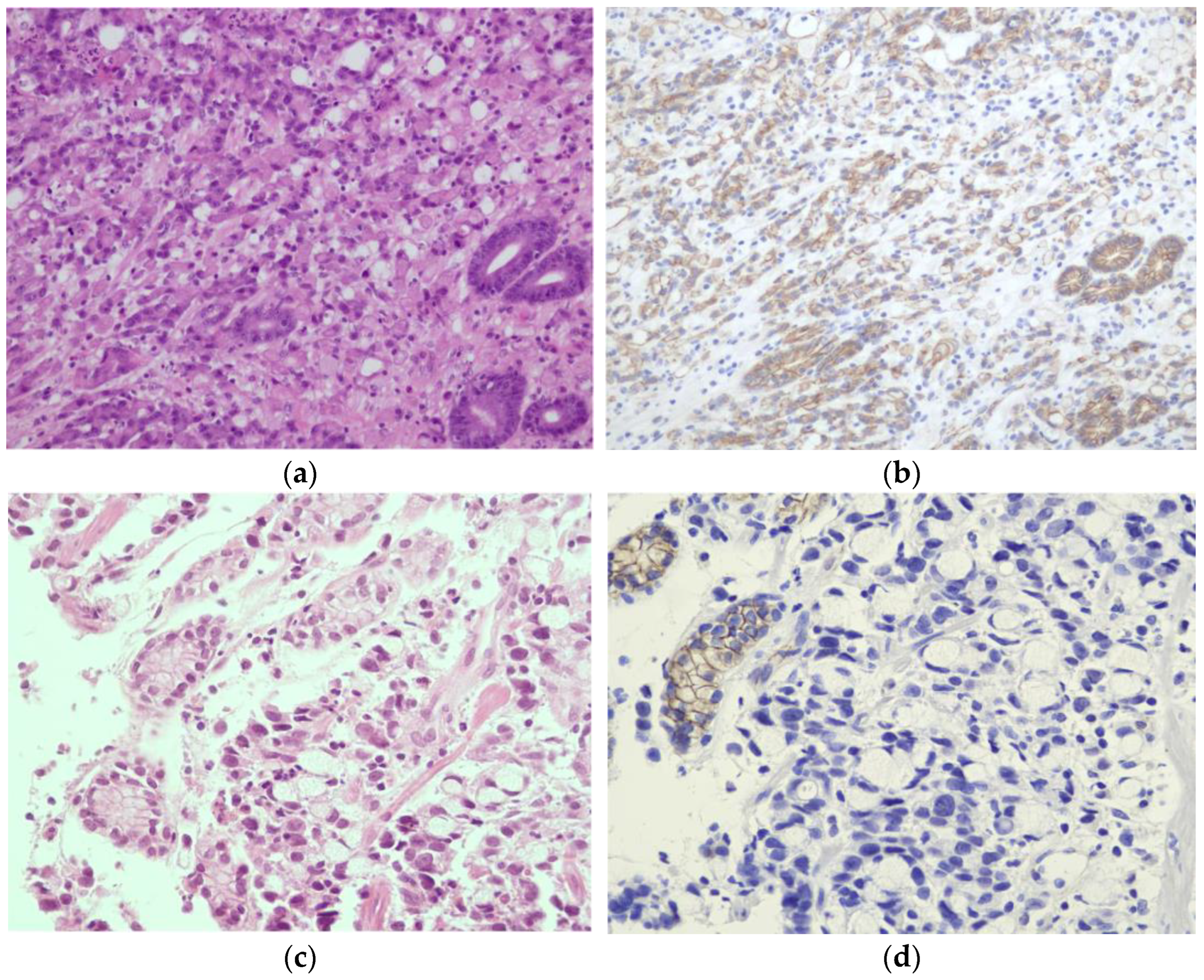 Cancers 15 04313 g003