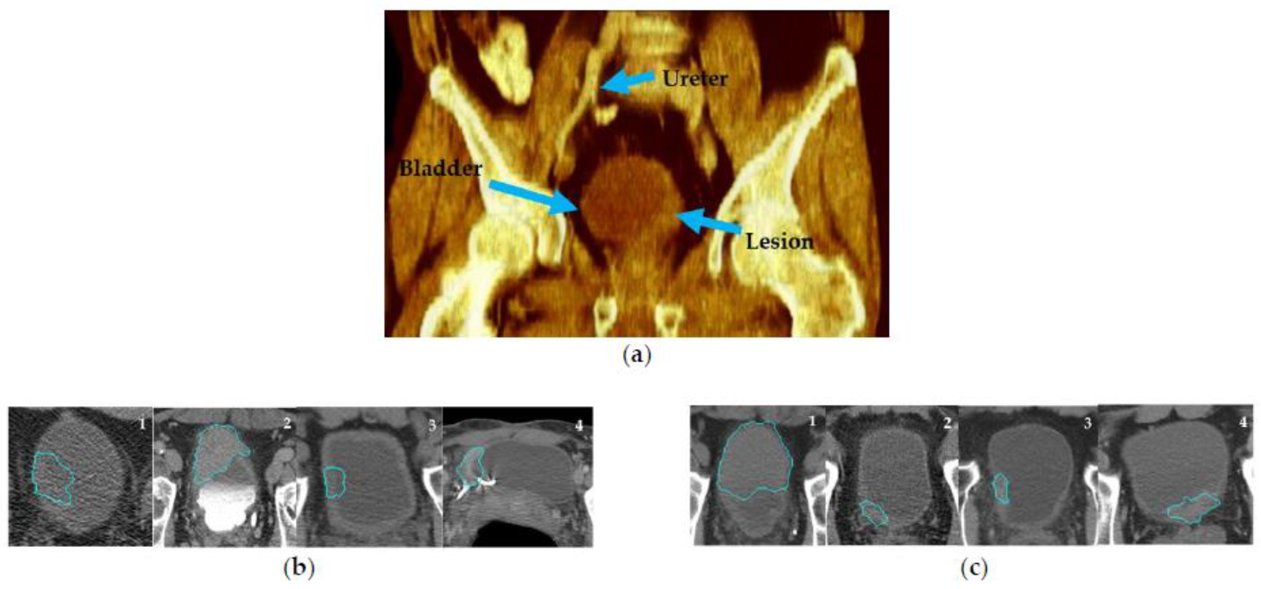 Cancers 15 04372 g003