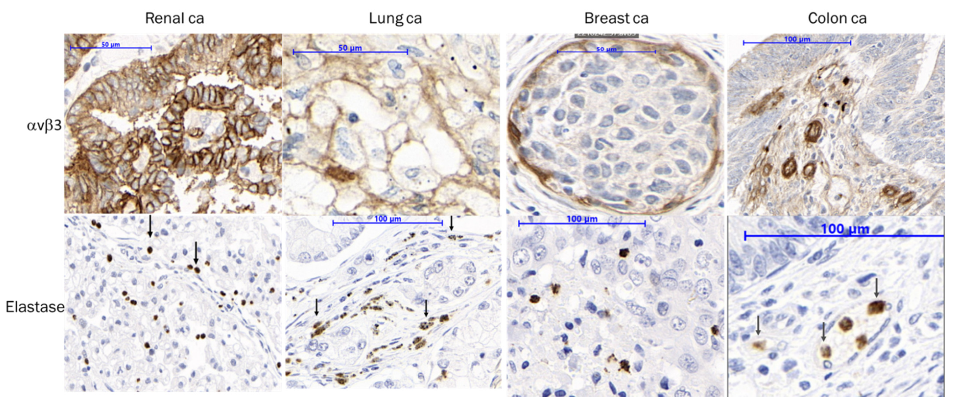 Cancers 15 04381 g004