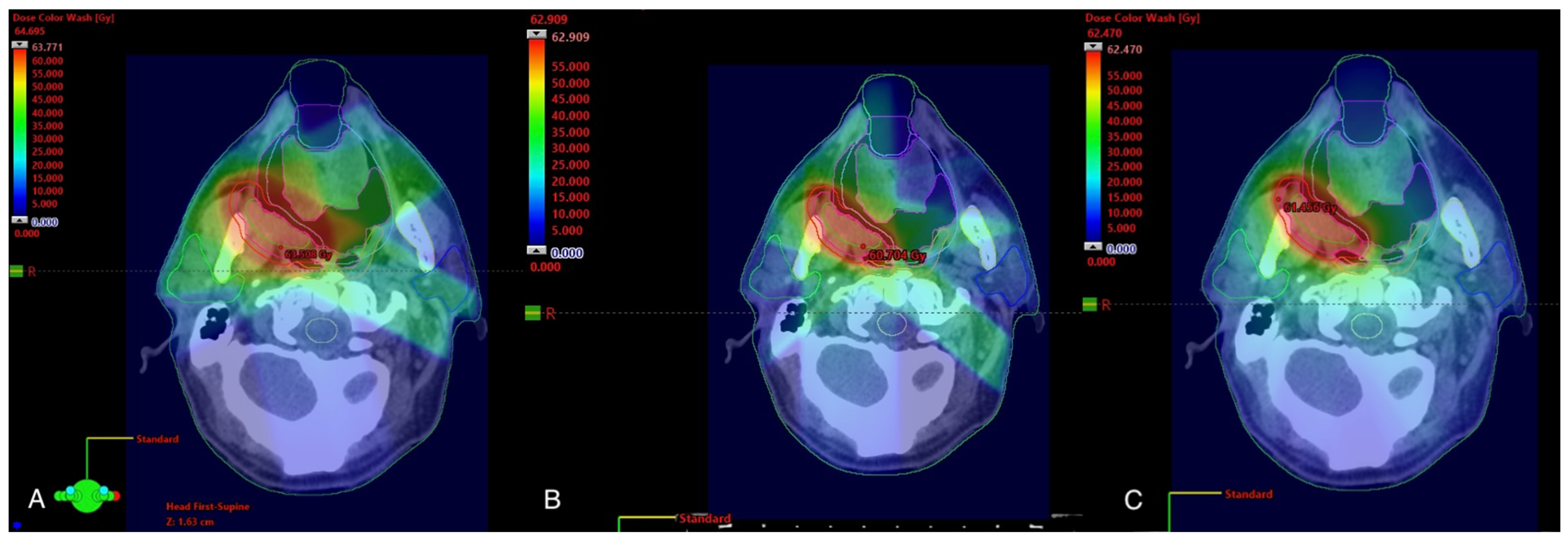 Cancers | Free Full-Text | An Overview of Head and Neck Tumor