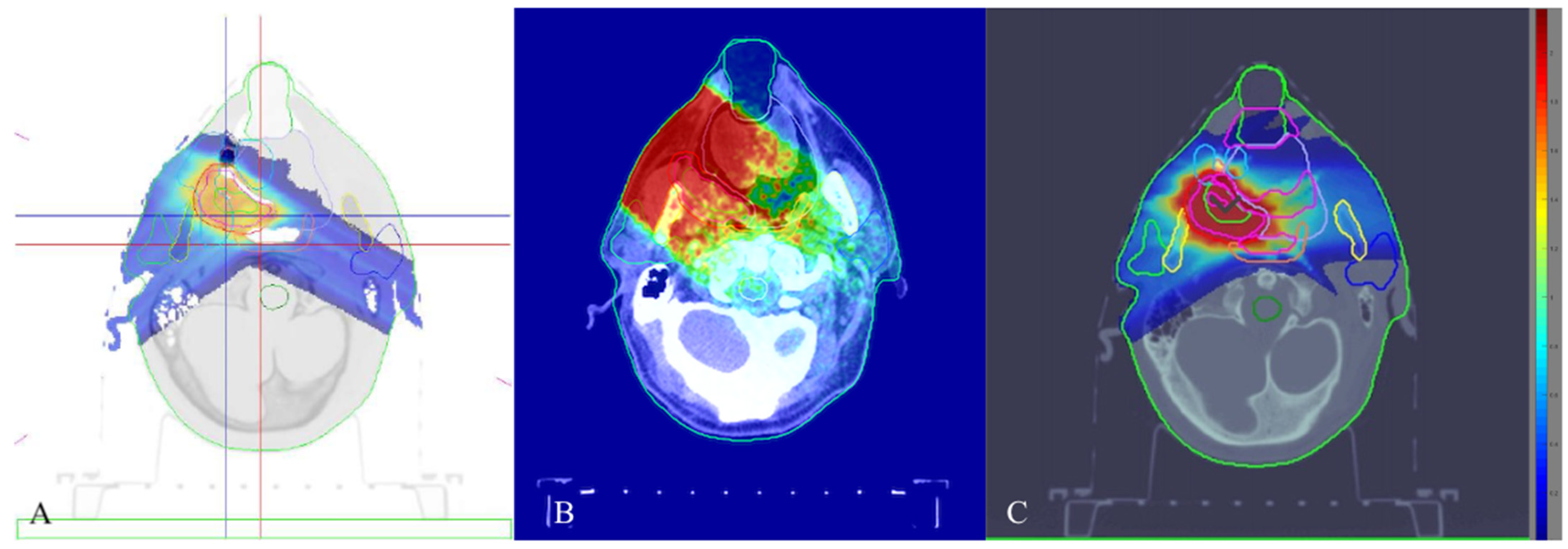 Cancers 15 04409 g002