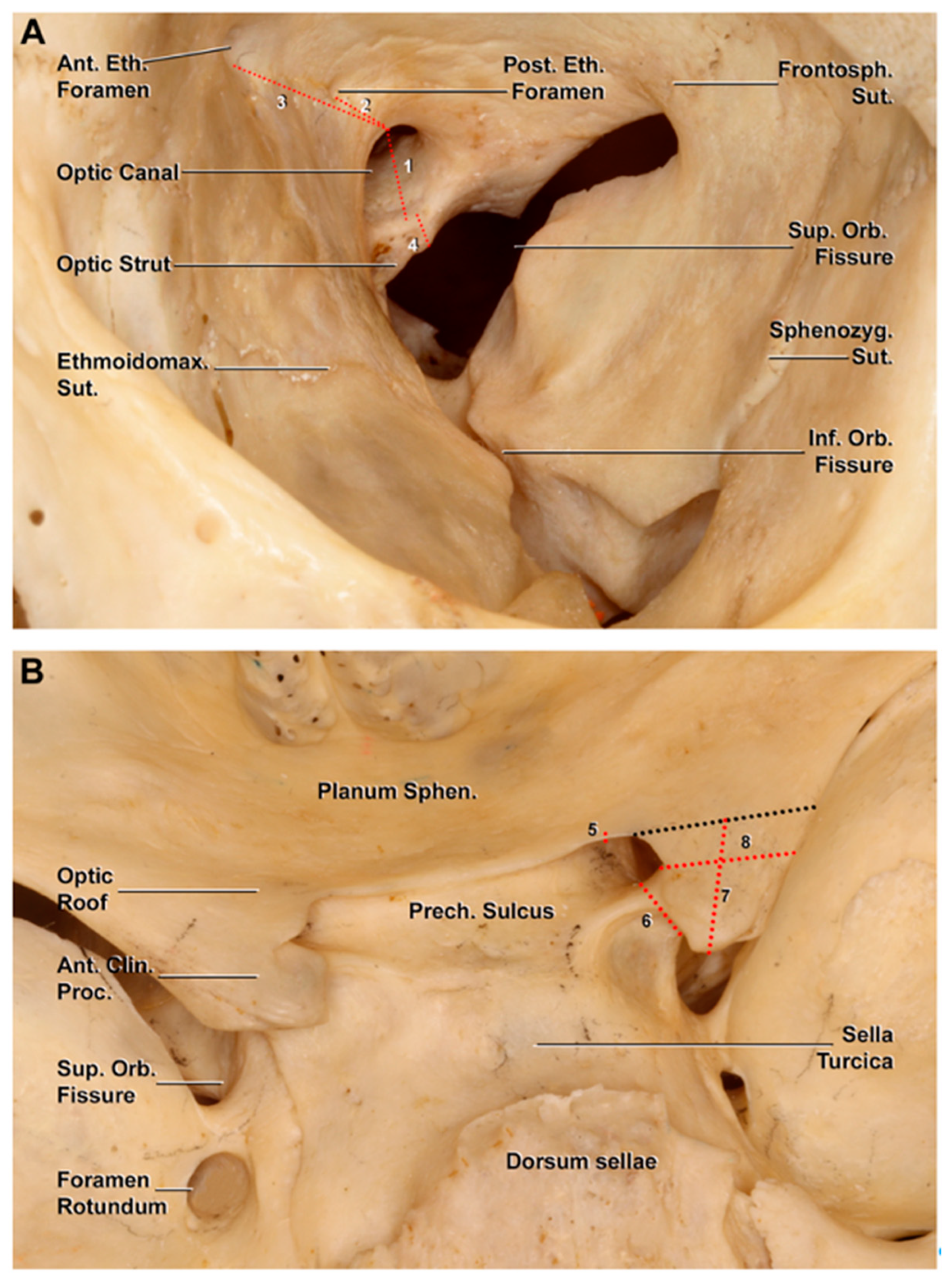 Mandibular nerve (CN V3), Encyclopedia, , Learn anatomy