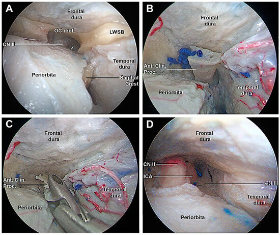 Surgical Anatomy of the Microscopic and Endoscopic