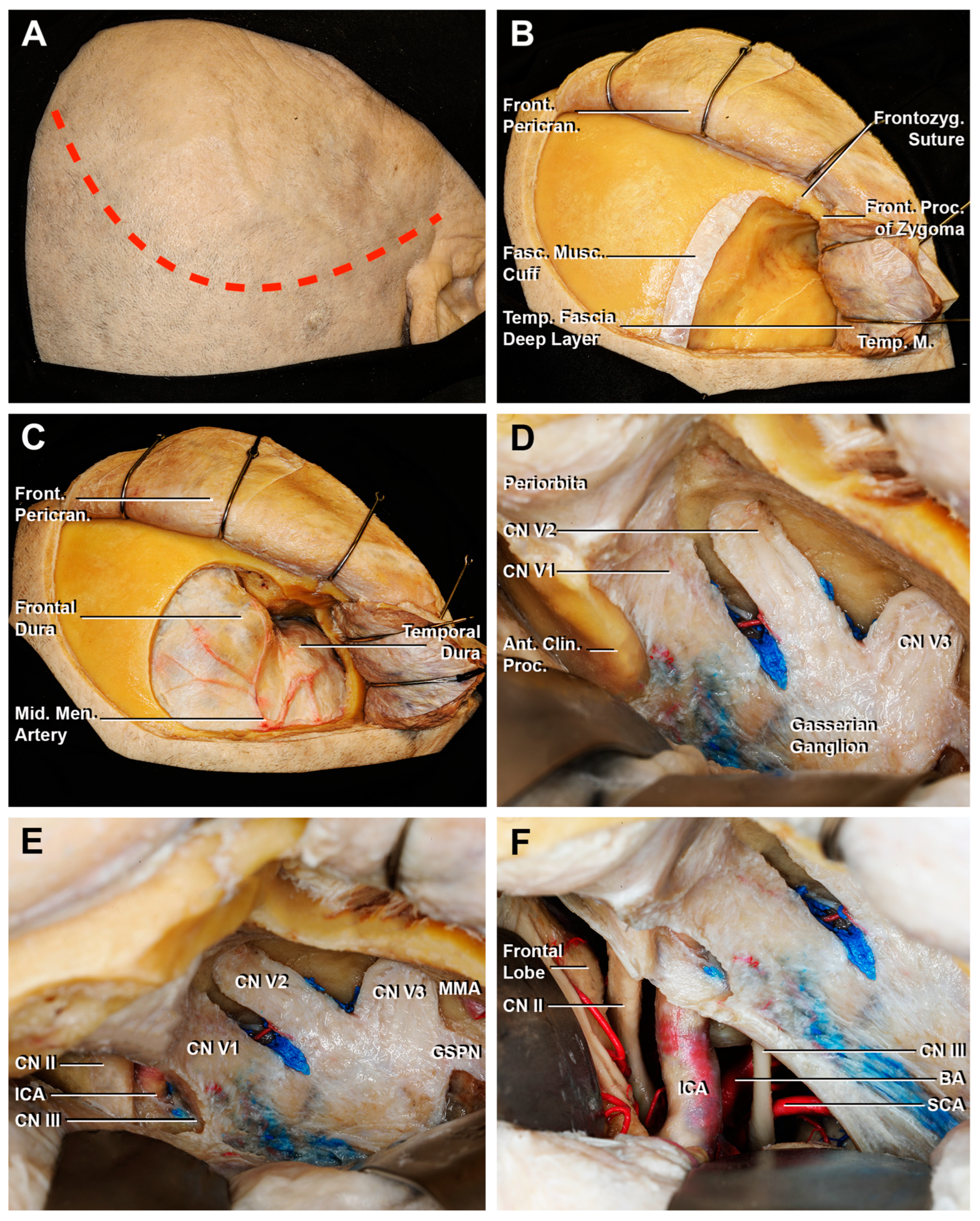 Cancers 15 04435 g008 Cancers 15 04435 g008