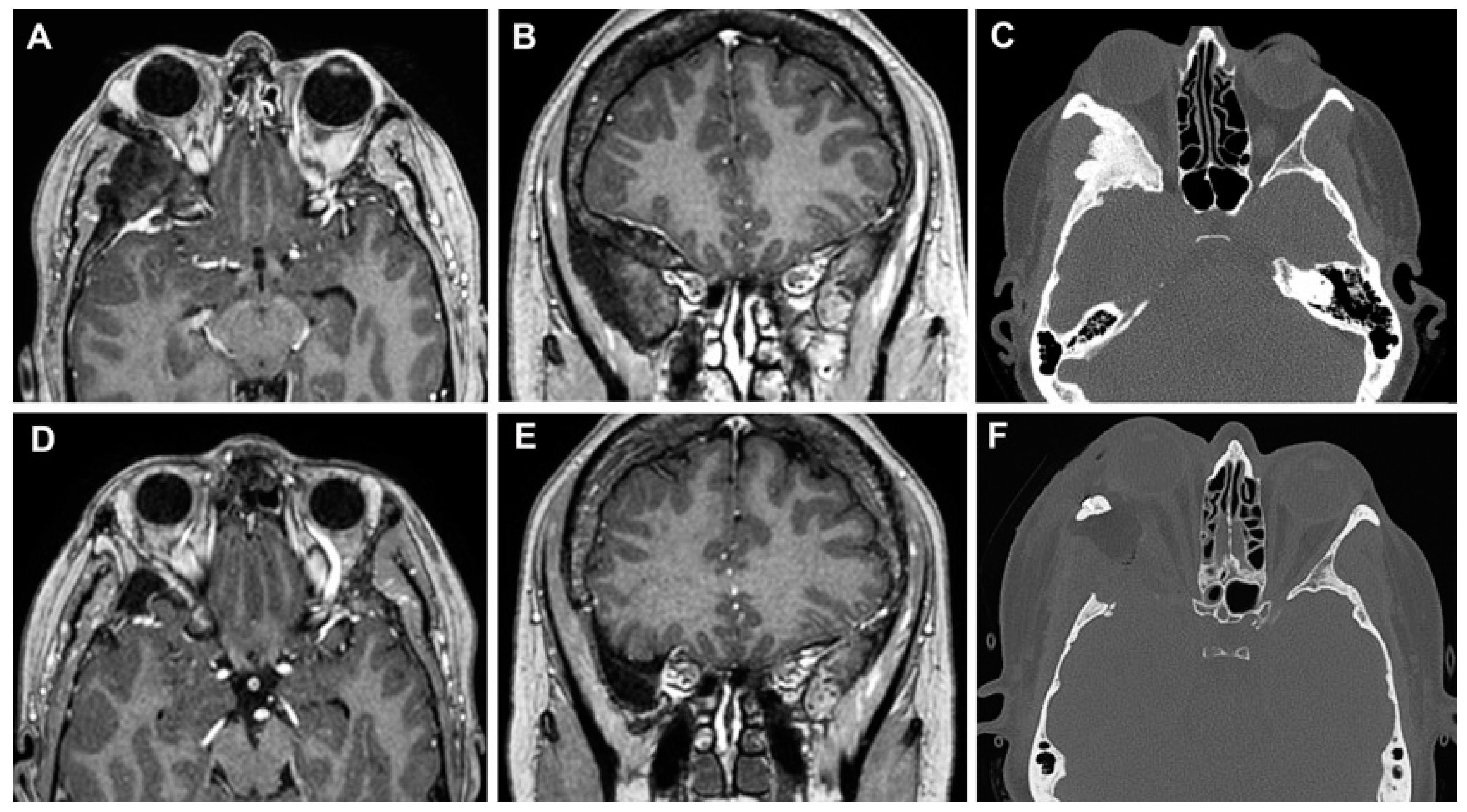 Cancers 15 04435 g010 Cancers 15 04435 g010