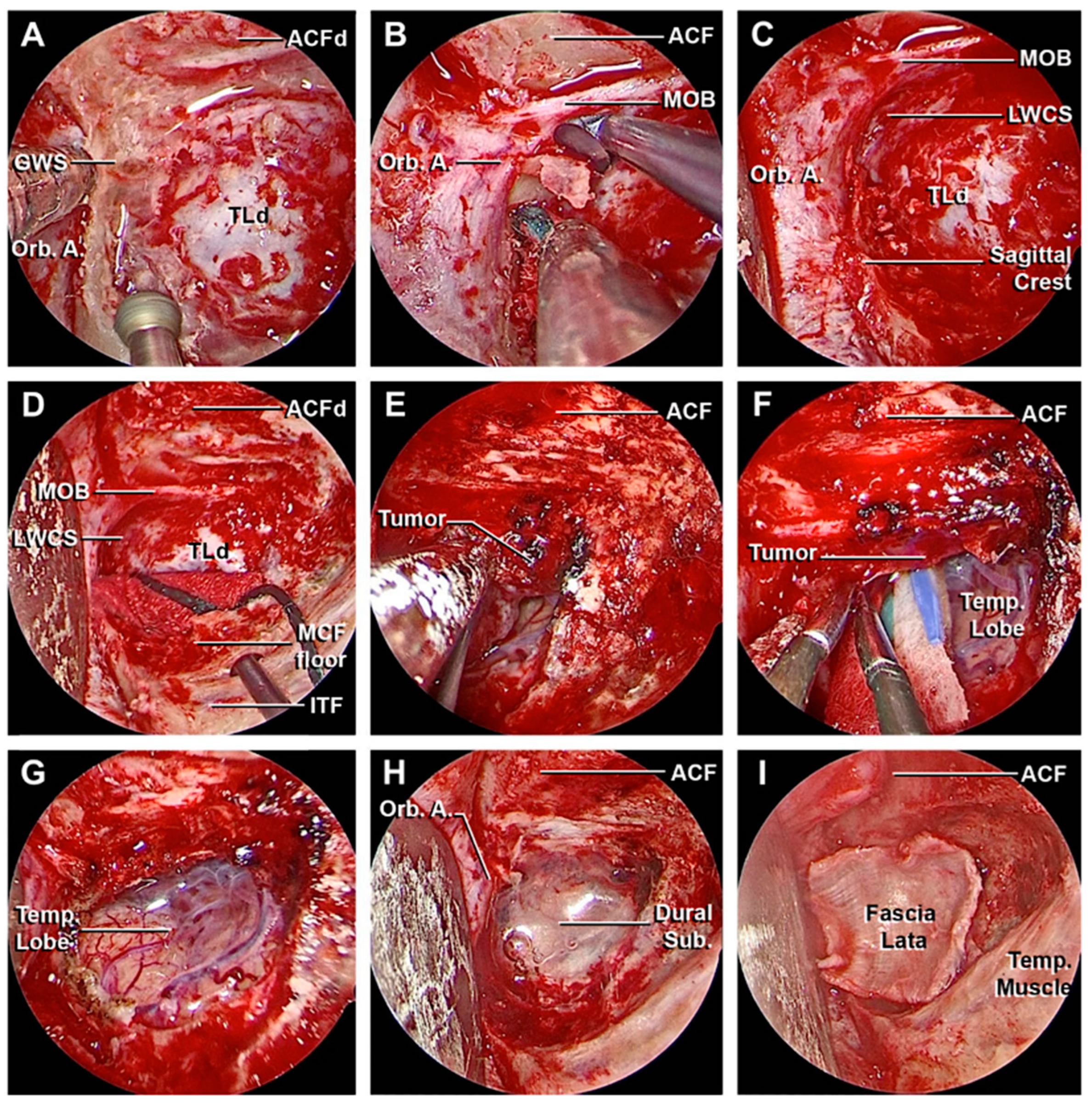 Cancers 15 04435 g012 Cancers 15 04435 g012