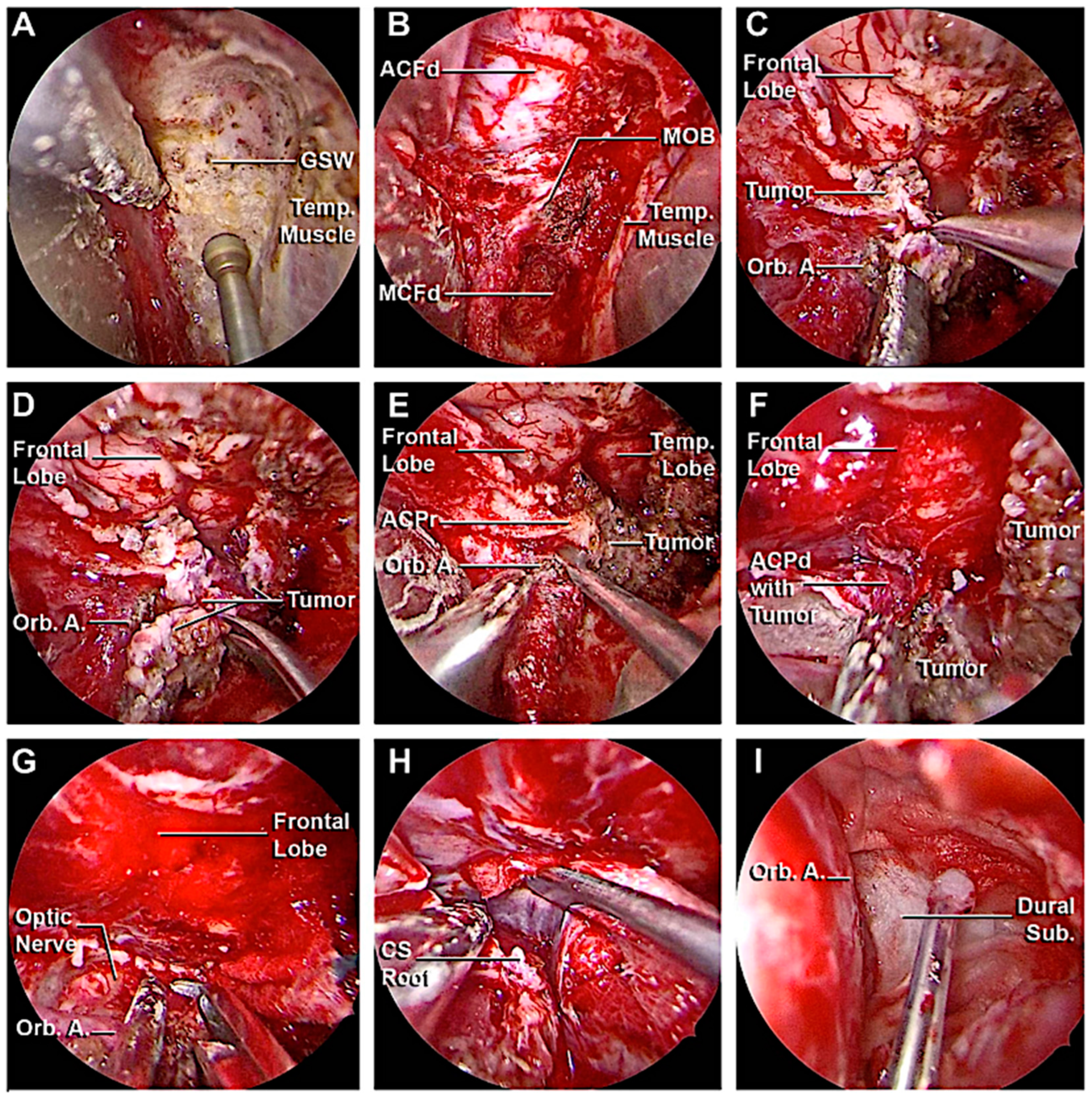Cancers 15 04435 g014 Cancers 15 04435 g014