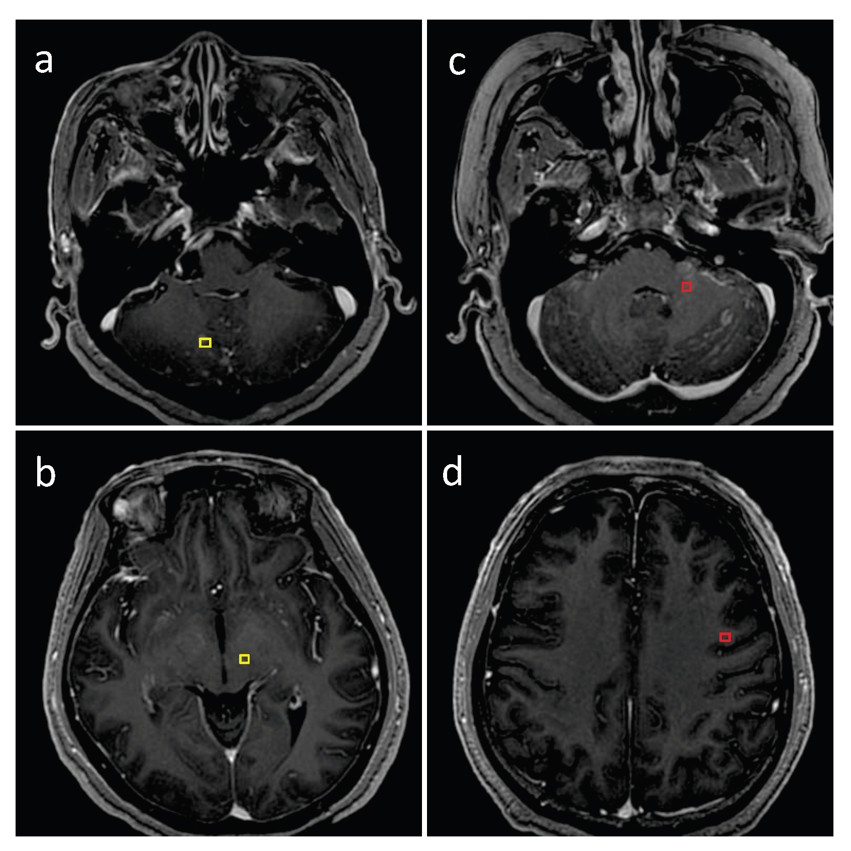 Cancers 15 04443 g012