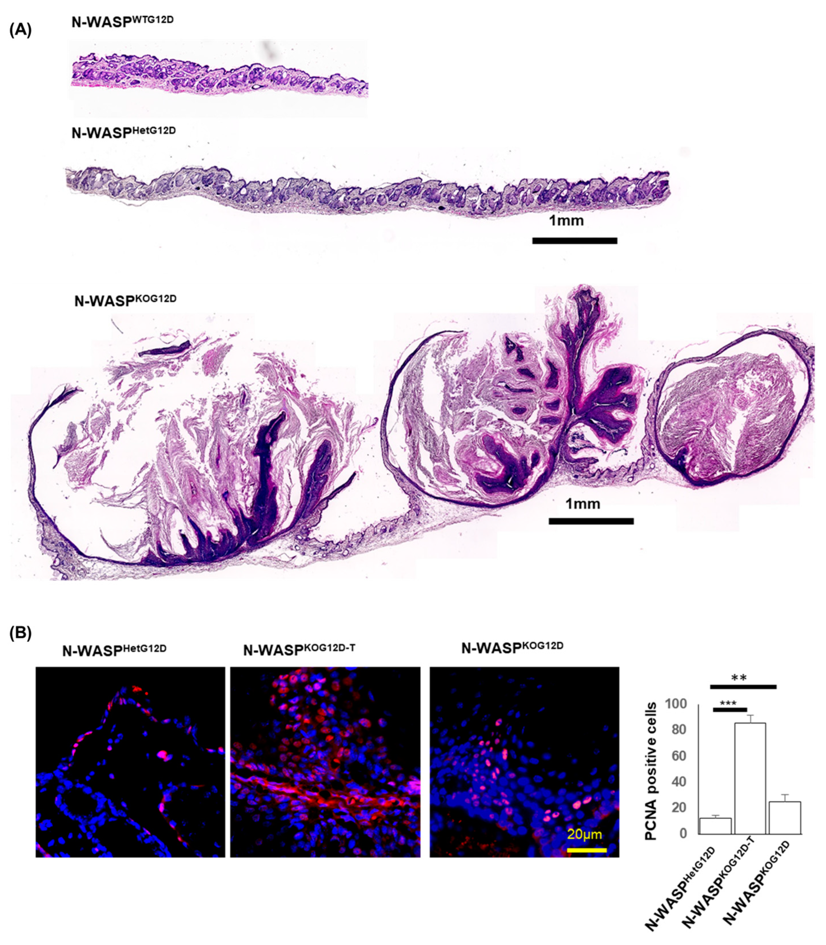 Cancers 15 04455 g004