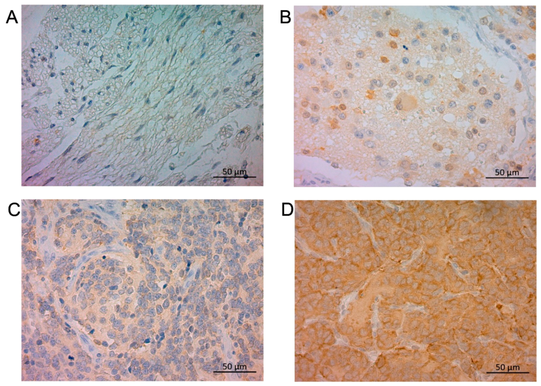 Cancers 15 04482 g001