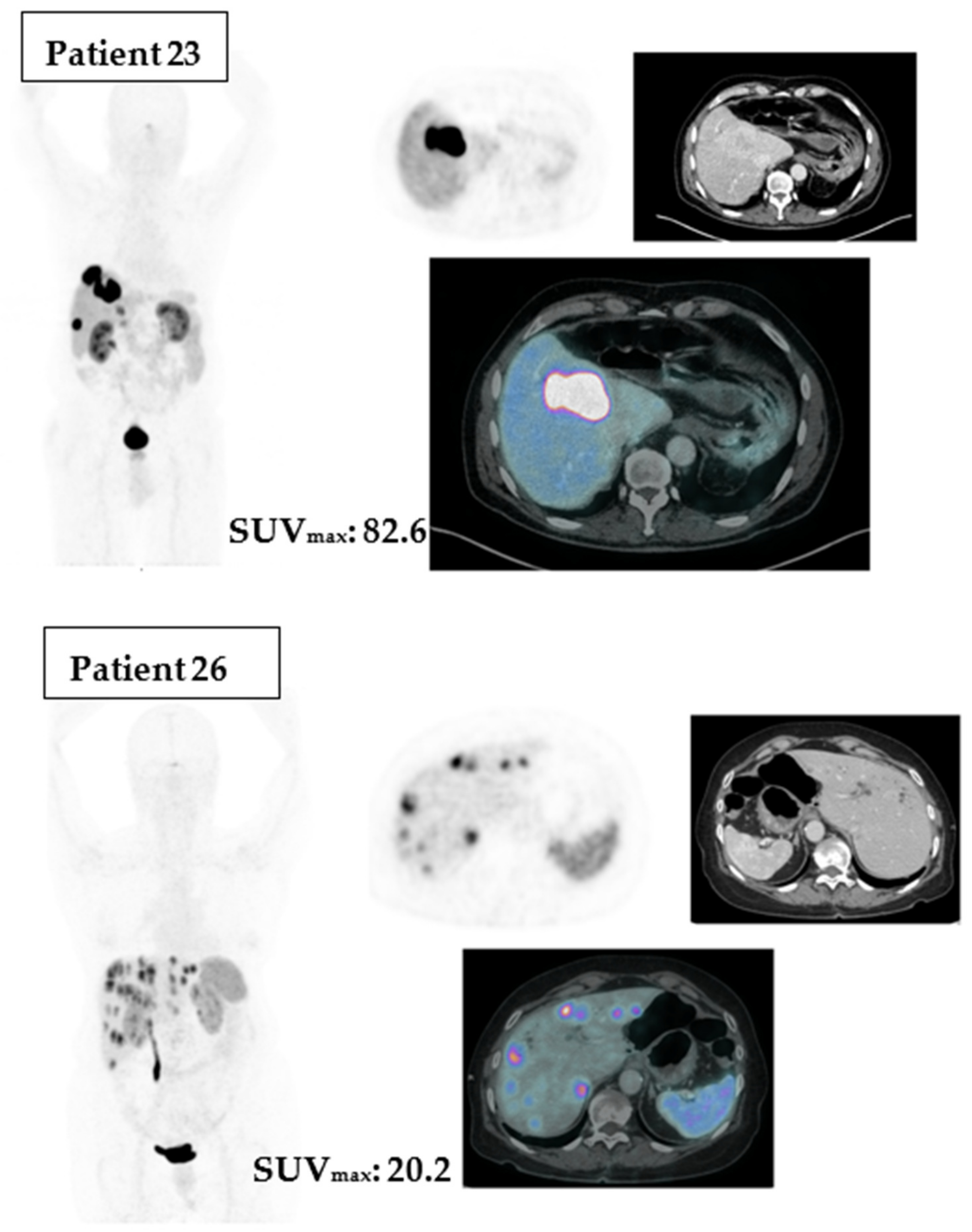 Cancers 15 04506 g005