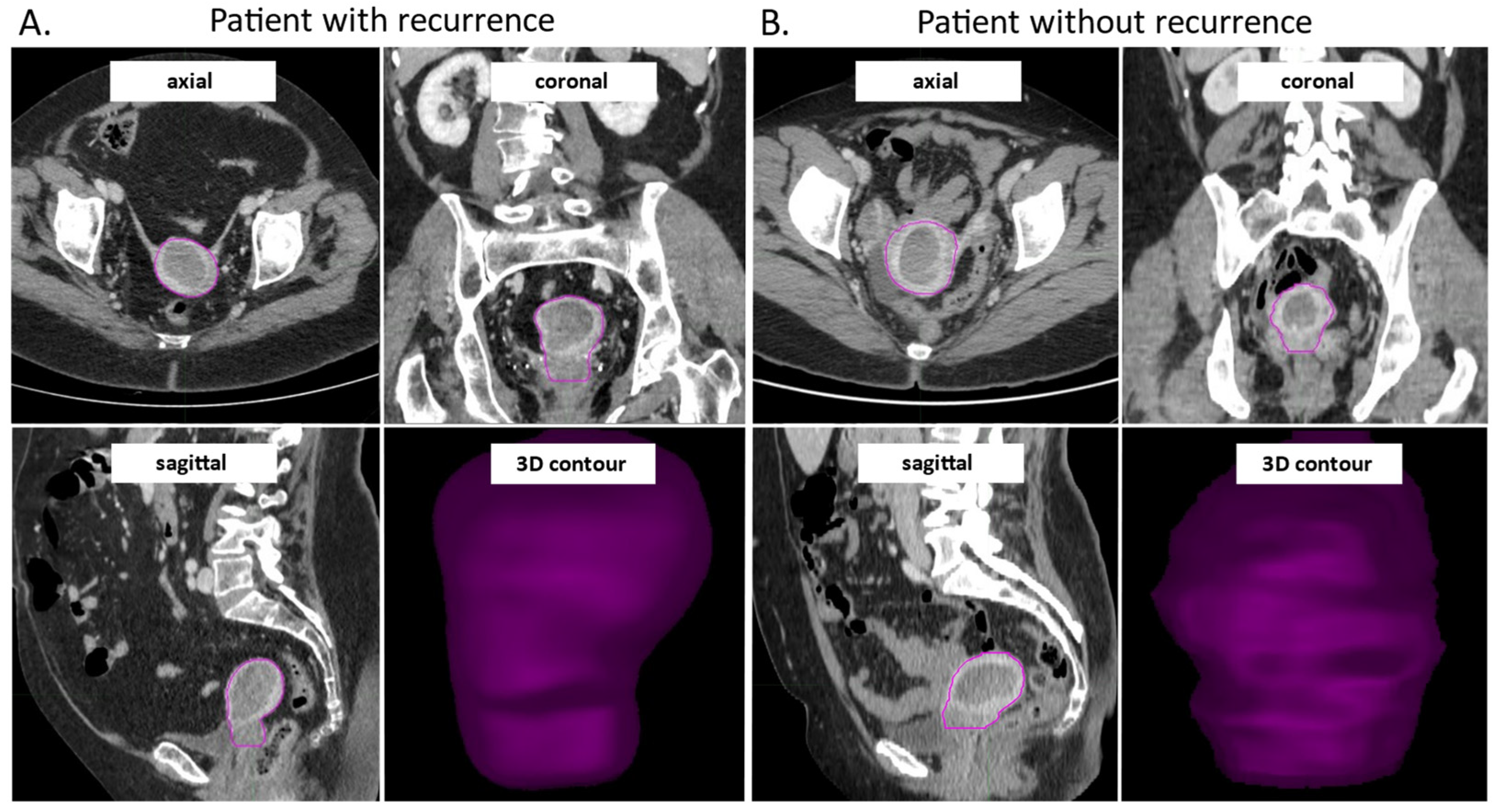 Cancers 15 04534 g002 Cancers 15 04534 g002