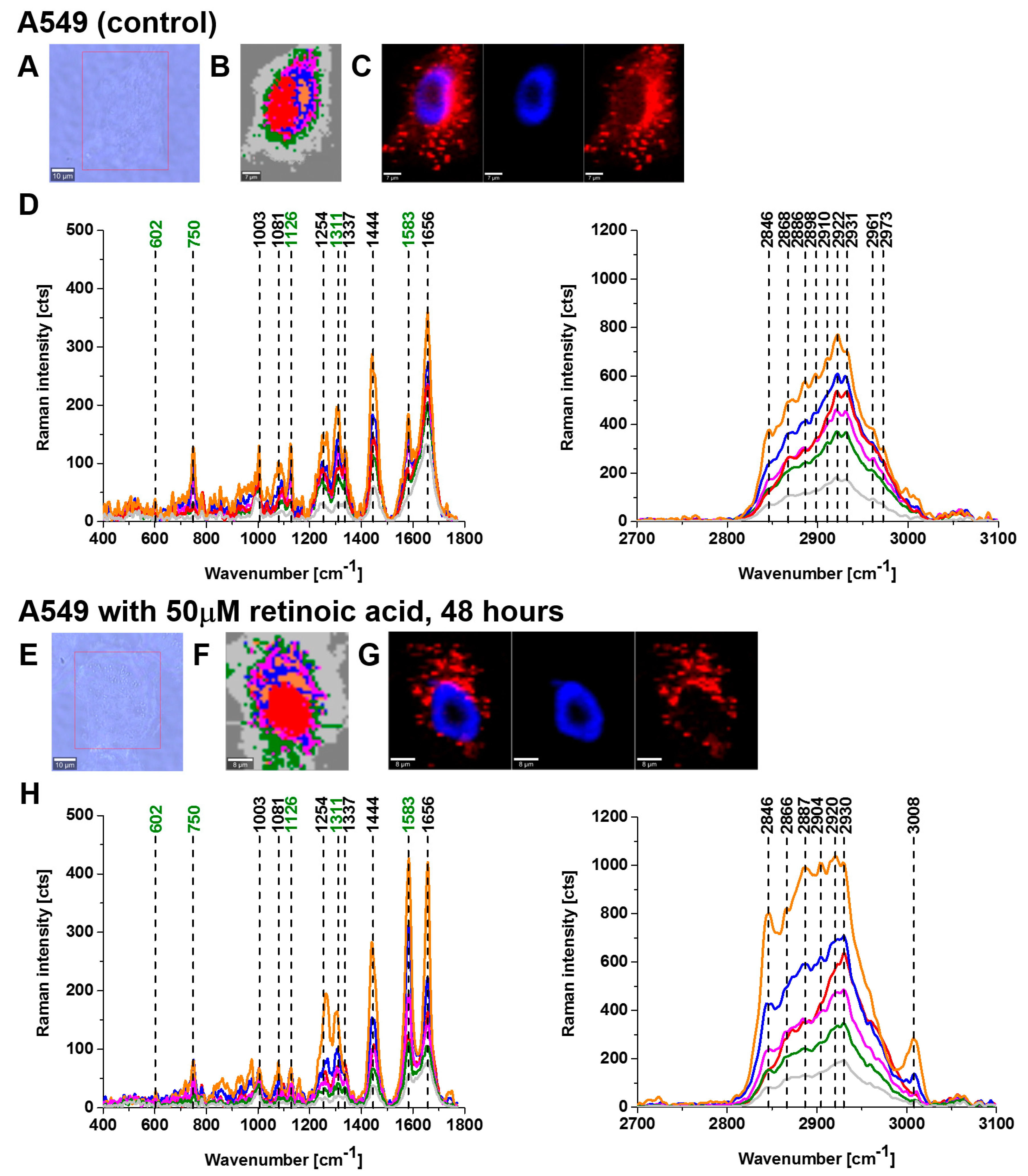 Cancers 15 04535 g003