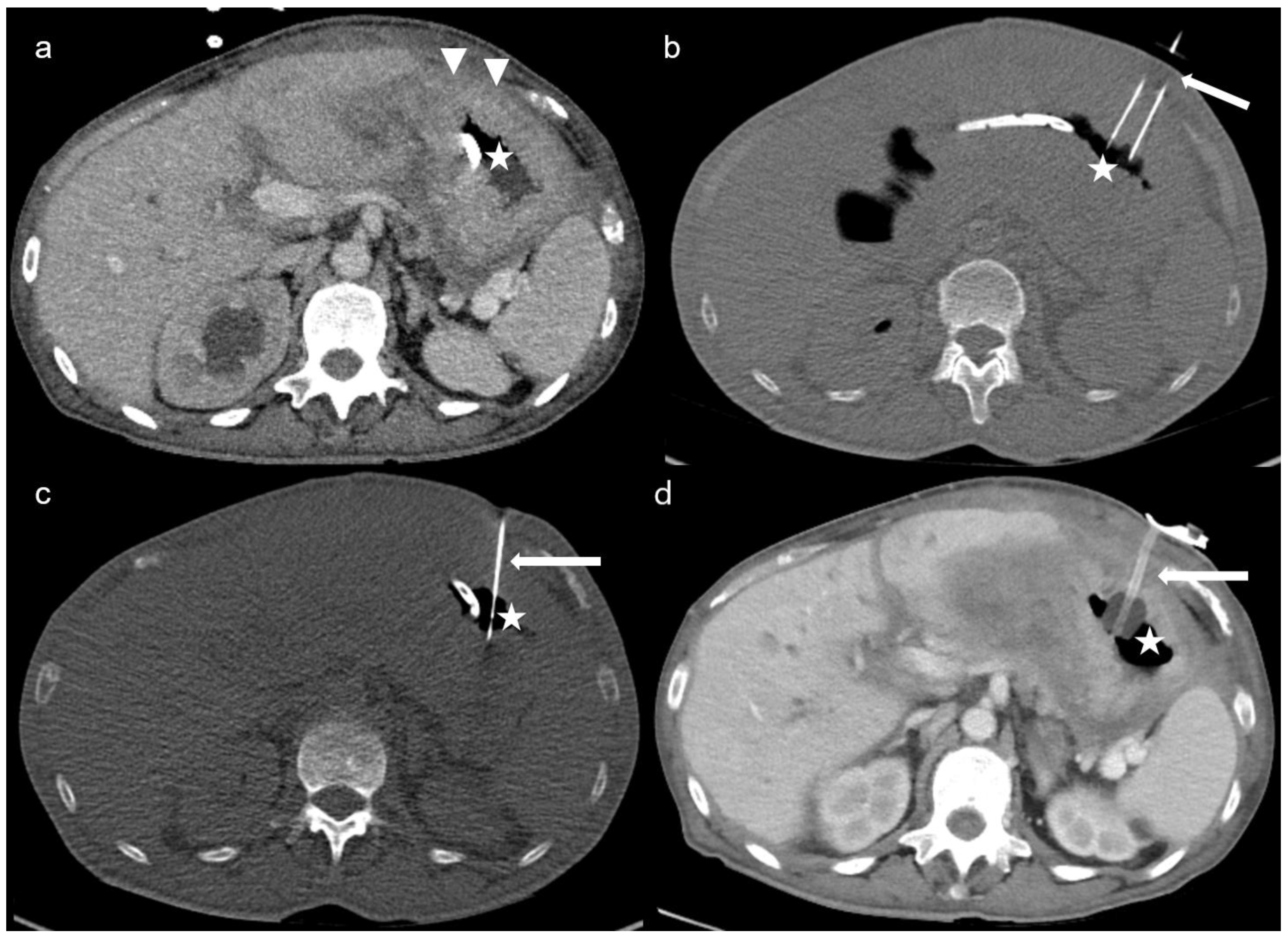 Cancers 15 04540 g001