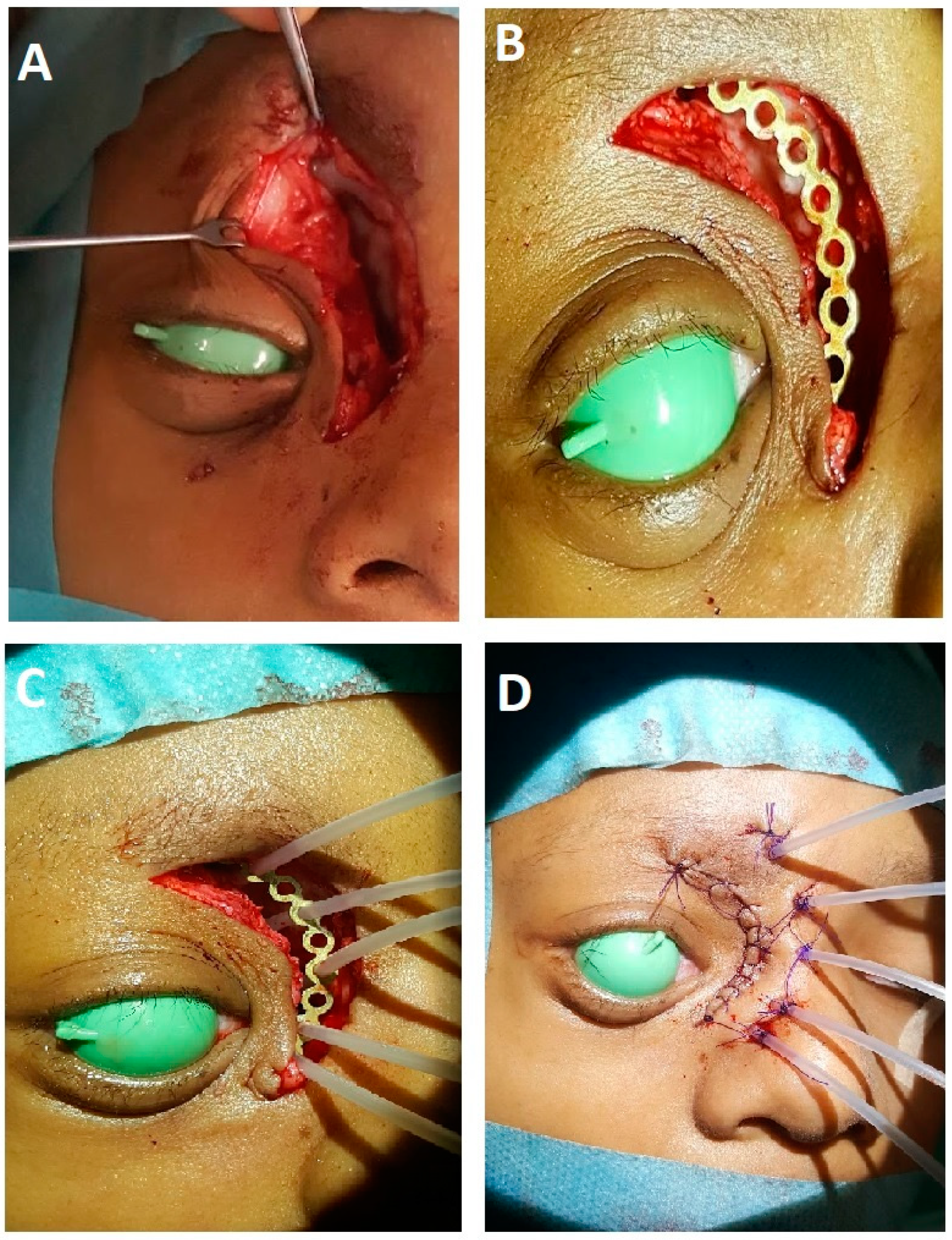 Cancers 15 04549 g001